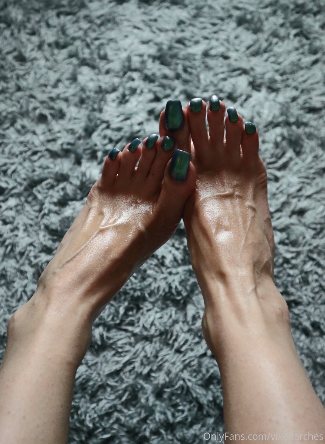 vixenarches feet photo 20