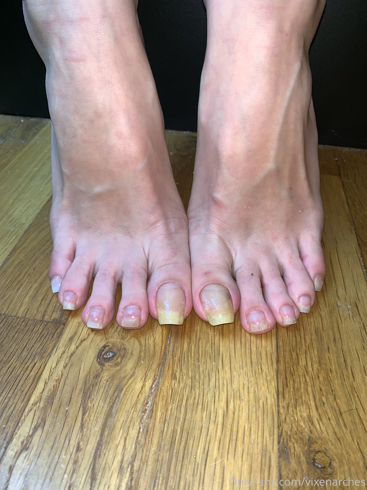 vixenarches feet photo 14