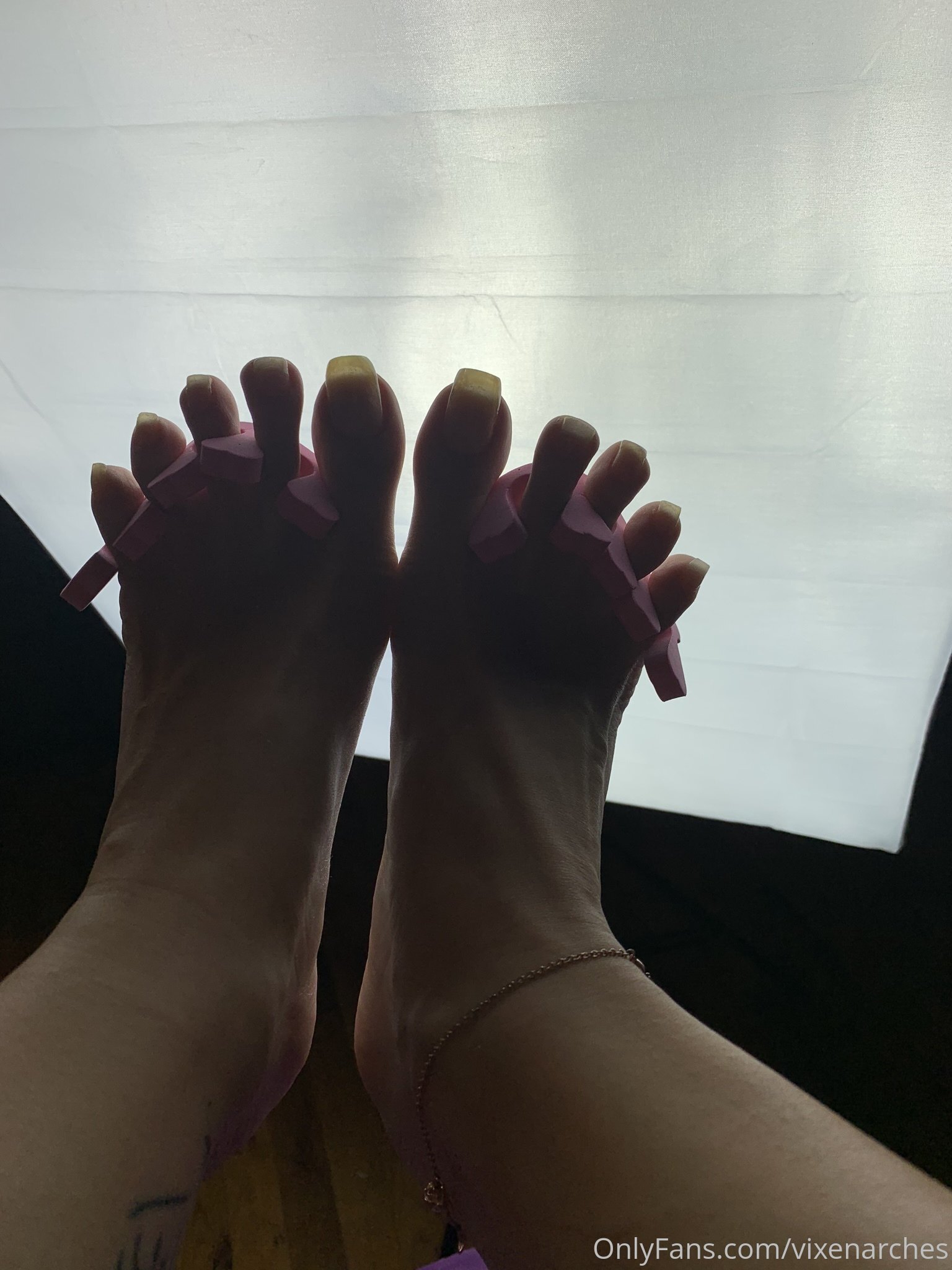 vixenarches feet photo 15