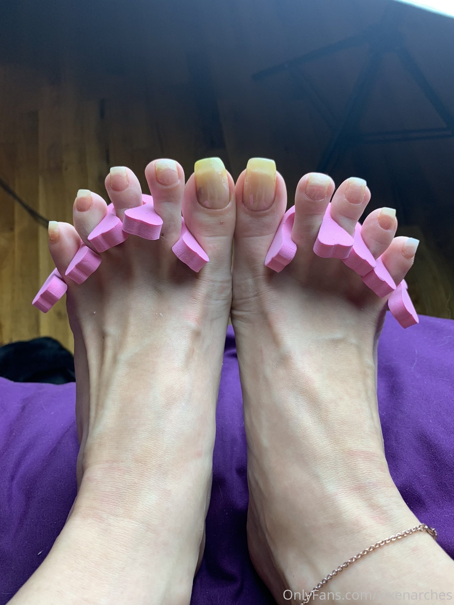 vixenarches feet photo 5