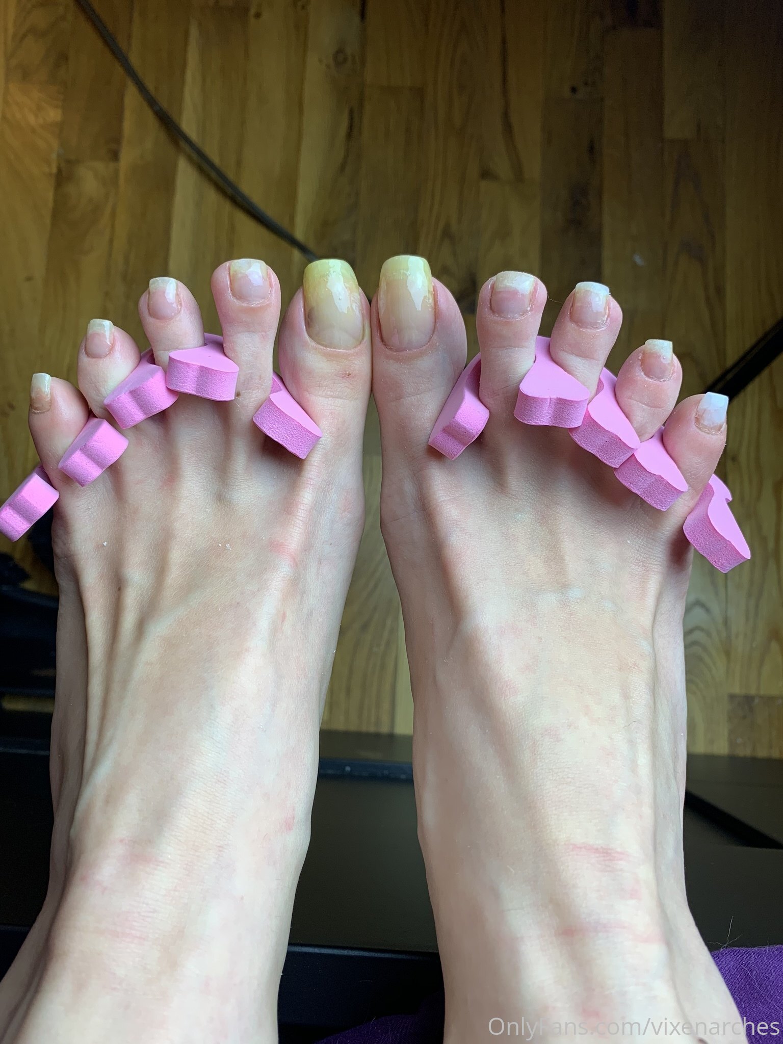 vixenarches feet photo 4