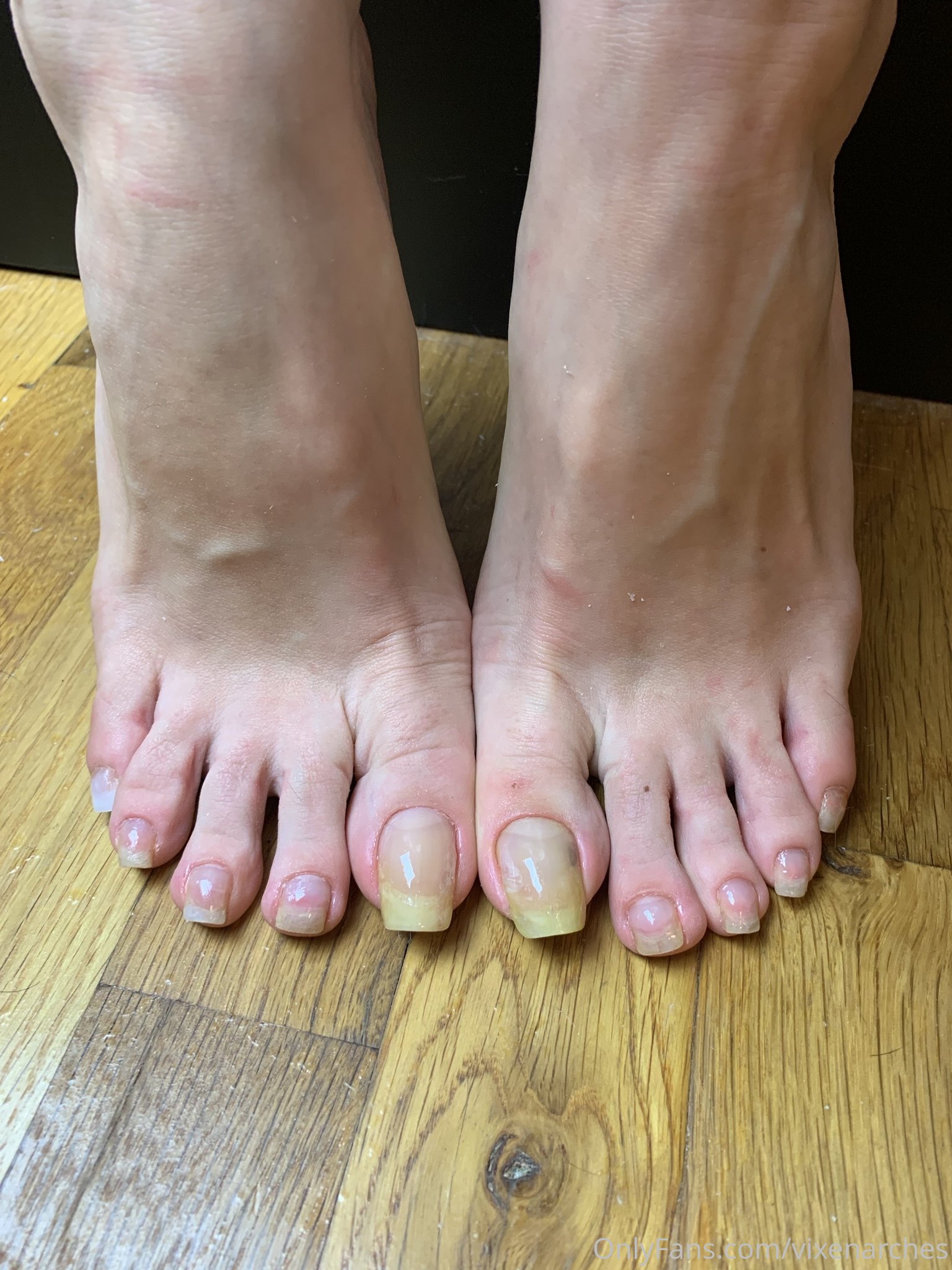 vixenarches feet photo 1