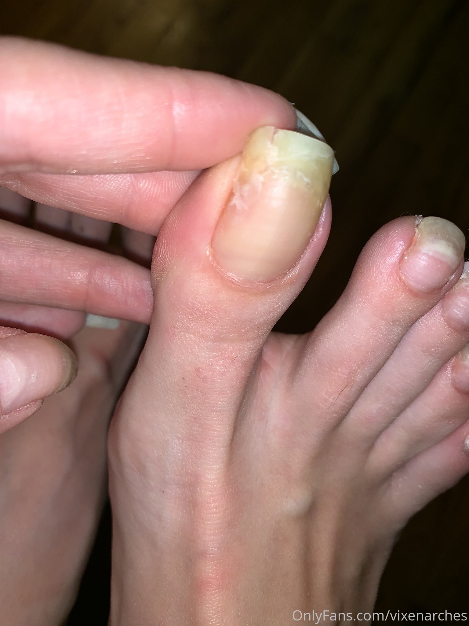 vixenarches feet photo 21
