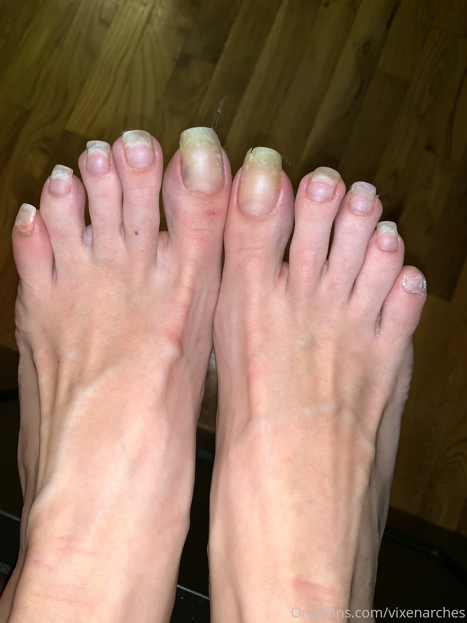 vixenarches feet photo 14