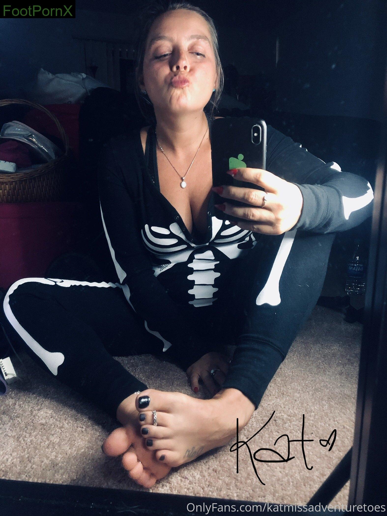 missadventuretoeskat