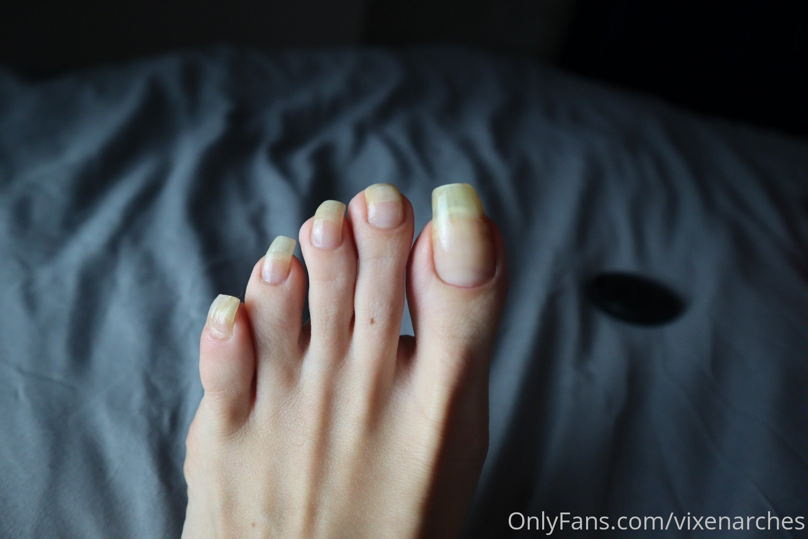 vixenarches feet photo 13