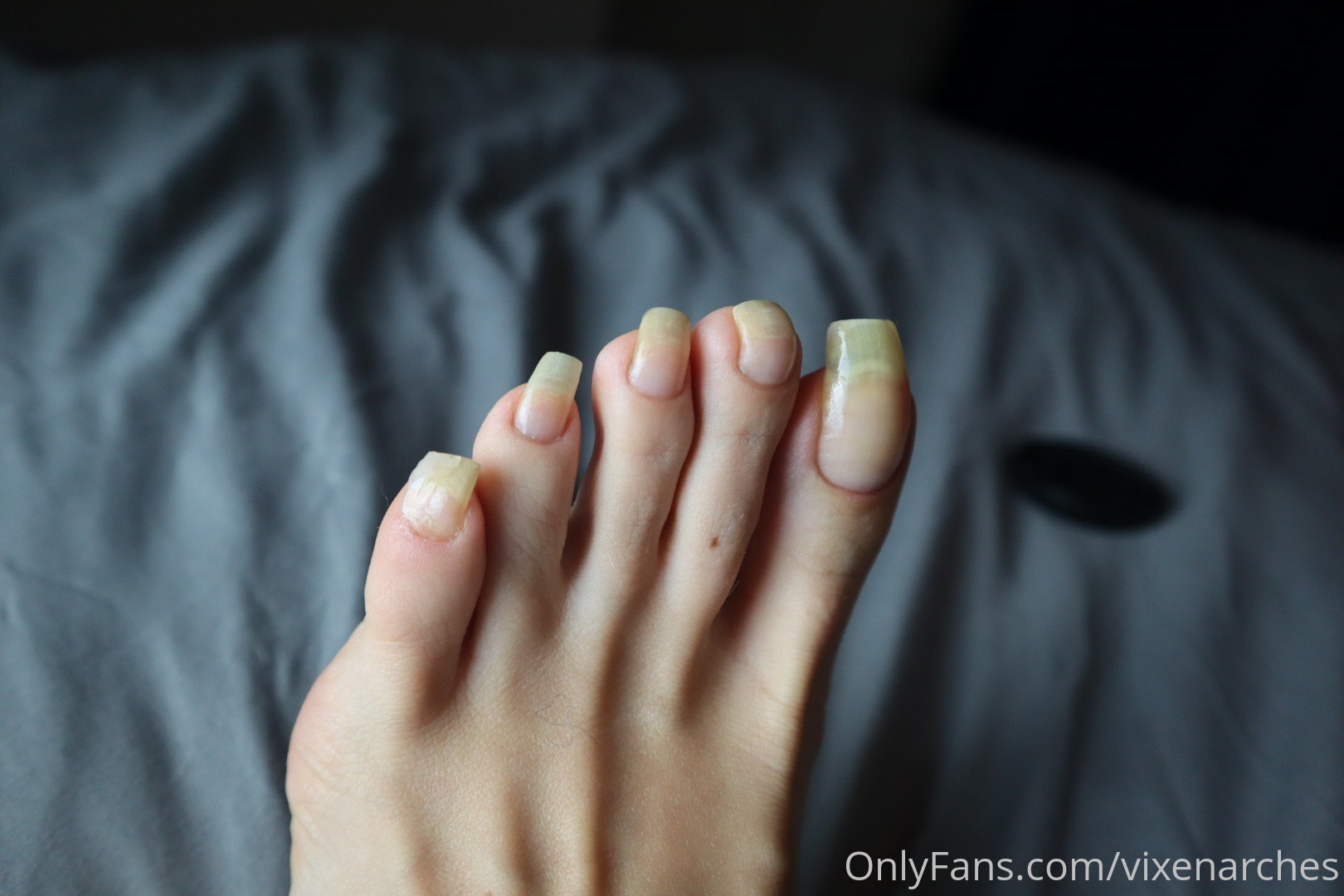 vixenarches feet photo 23