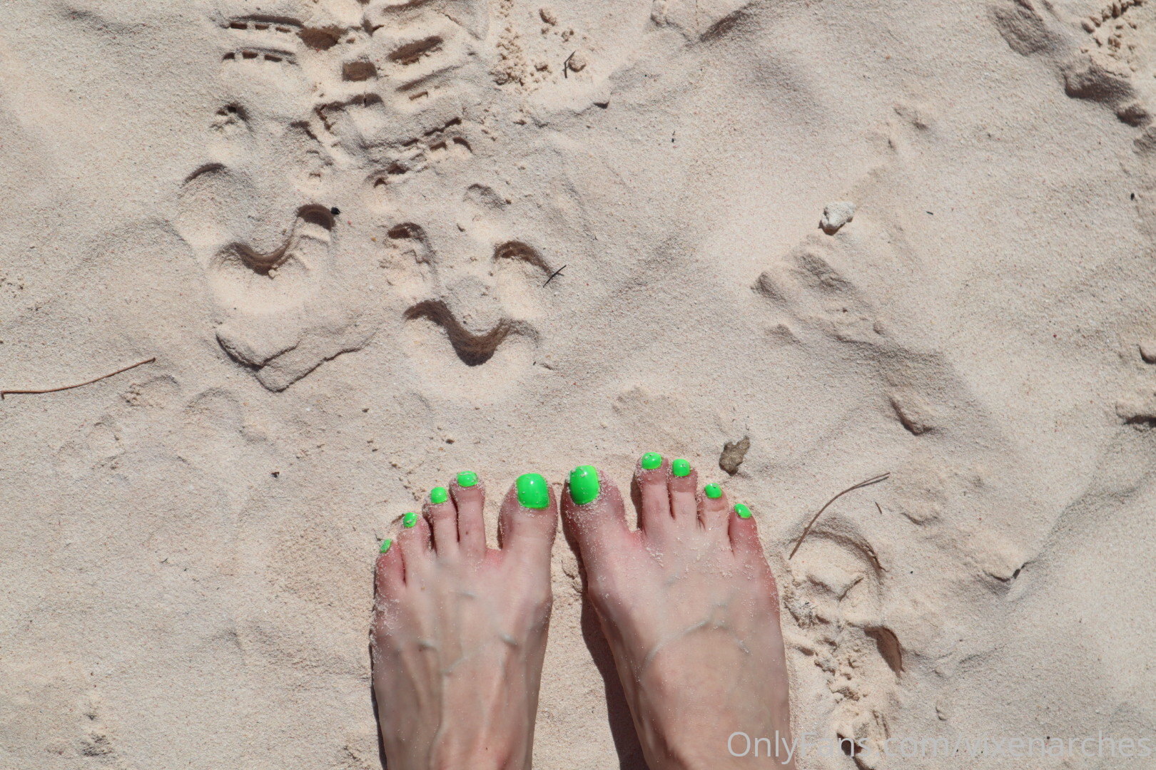 vixenarches feet photo 18