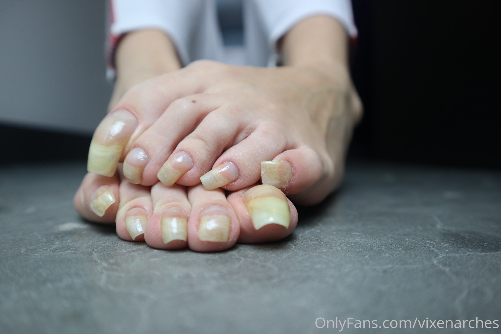 vixenarches feet photo 15
