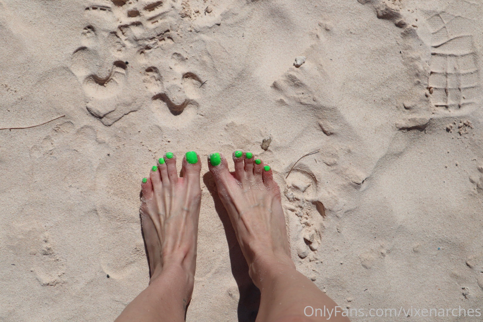 vixenarches feet photo 17