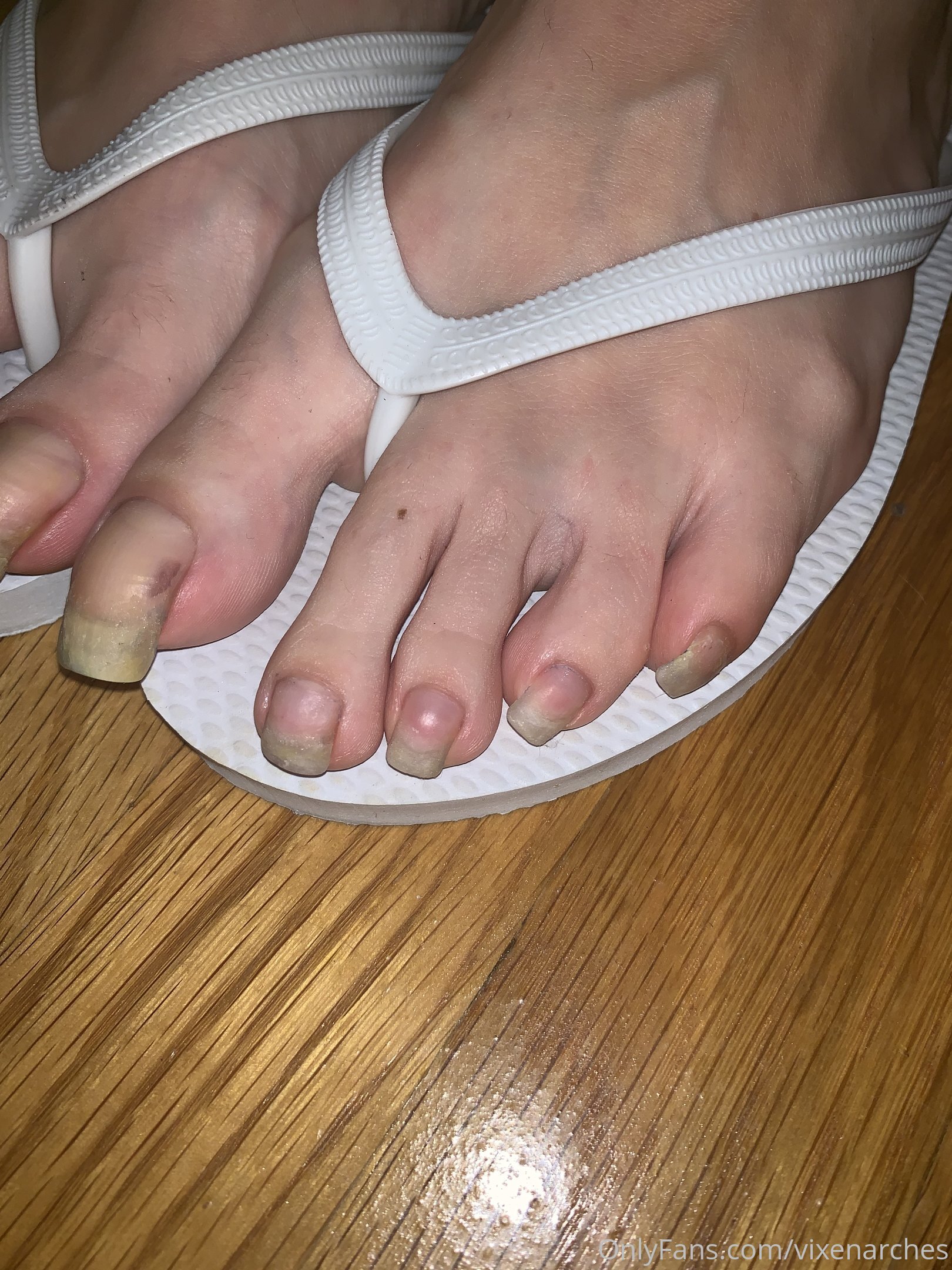 vixenarches feet photo 17