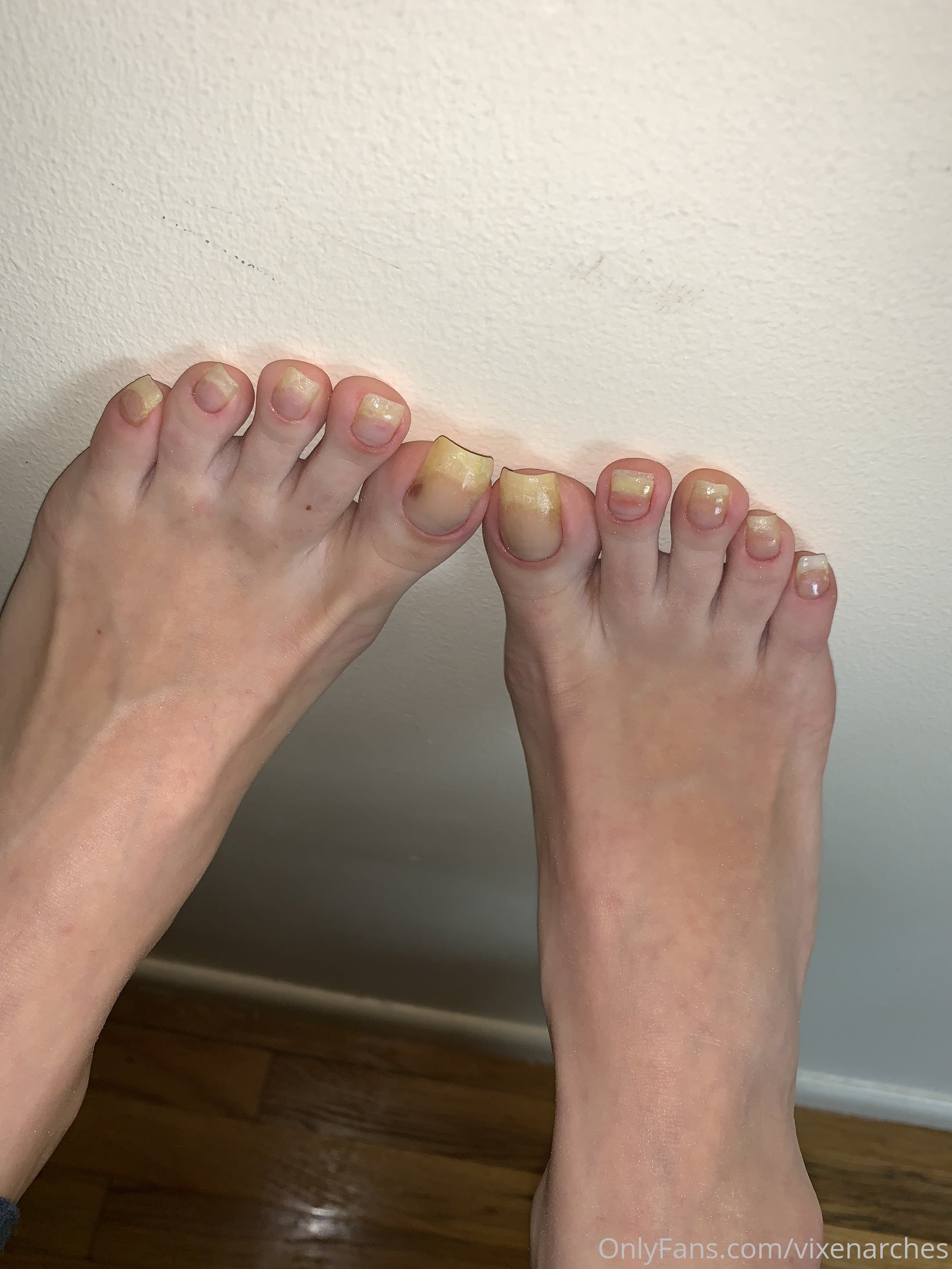 vixenarches feet photo 6