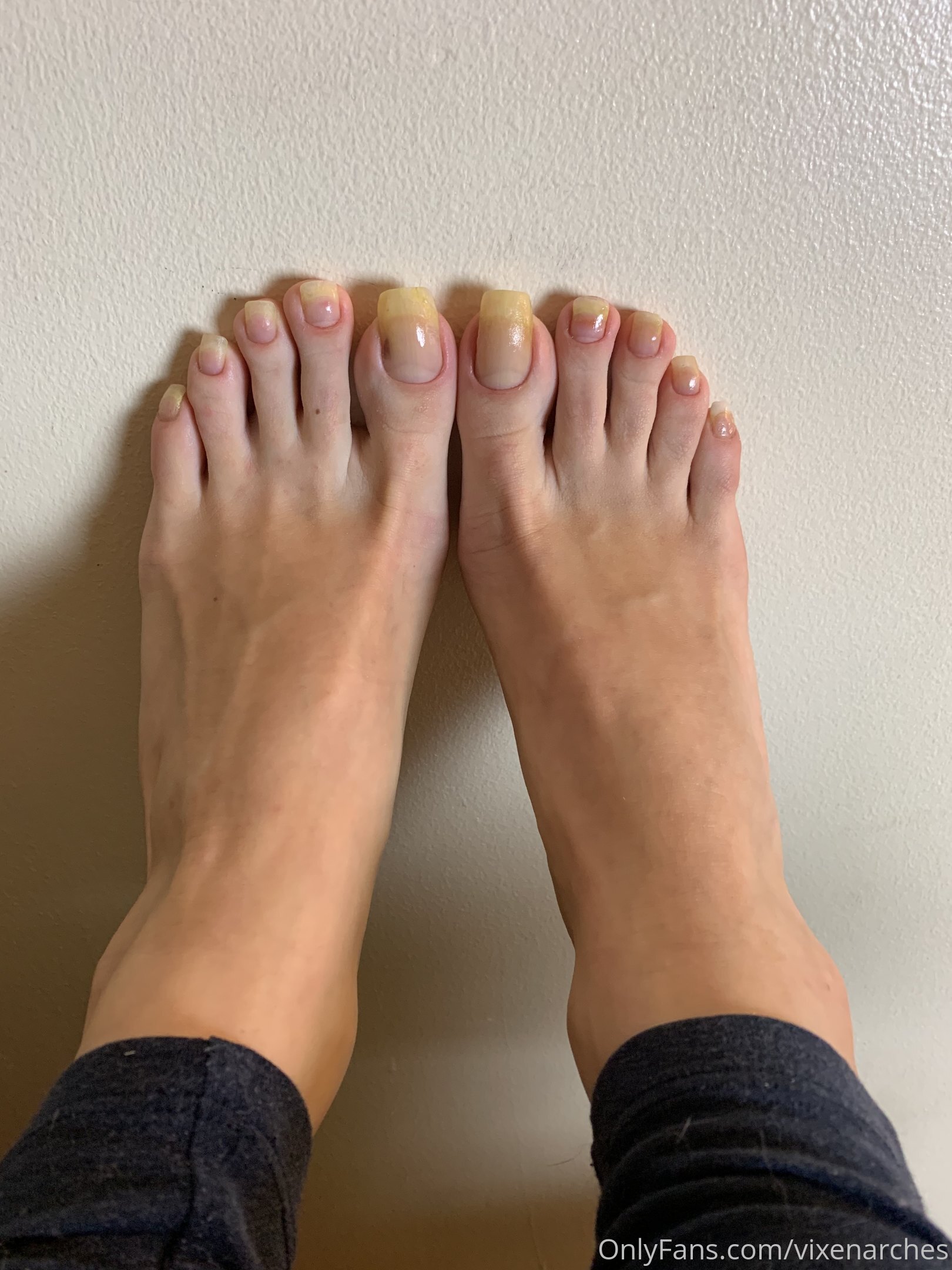 vixenarches feet photo 5