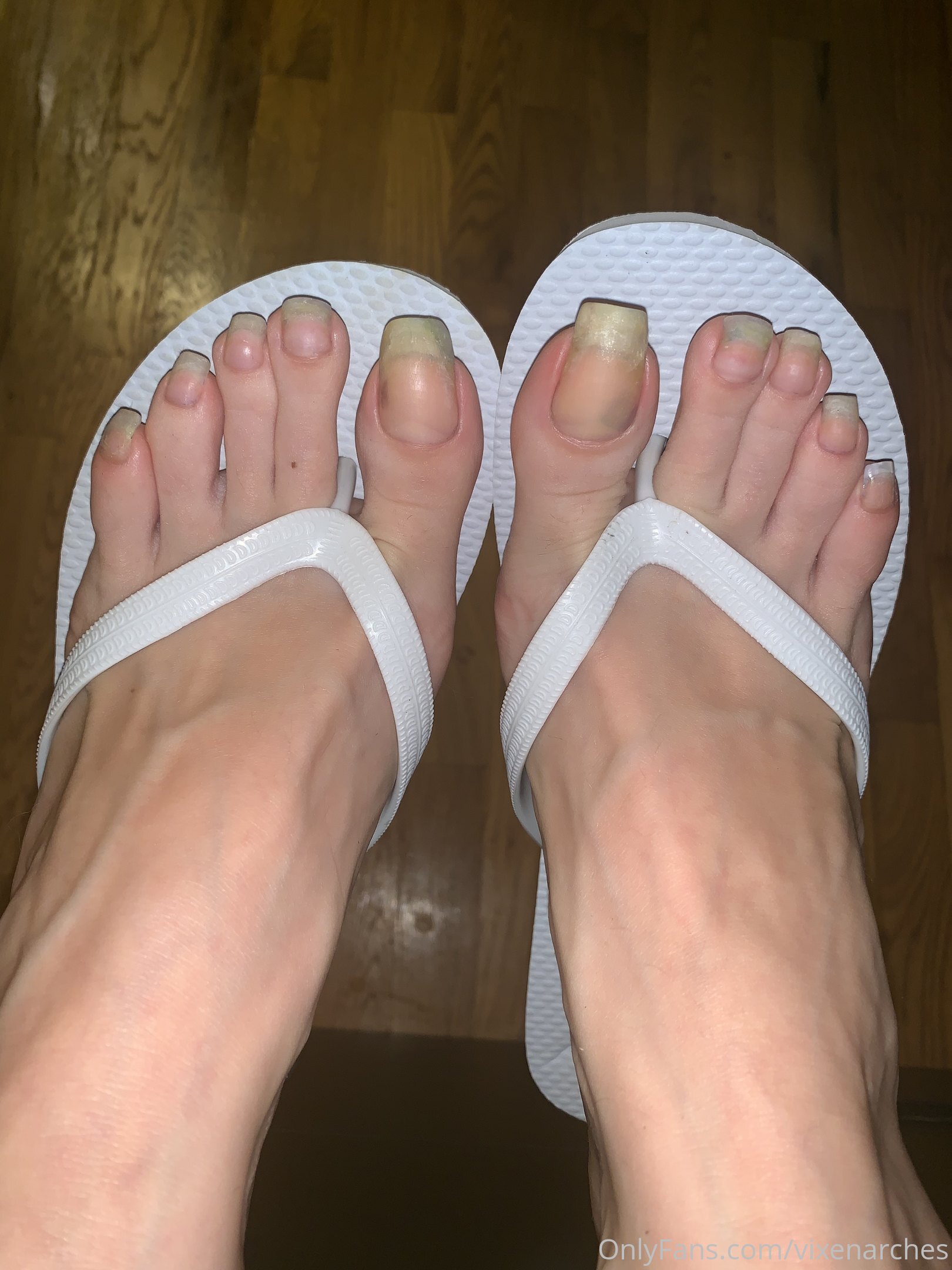 vixenarches feet photo 7