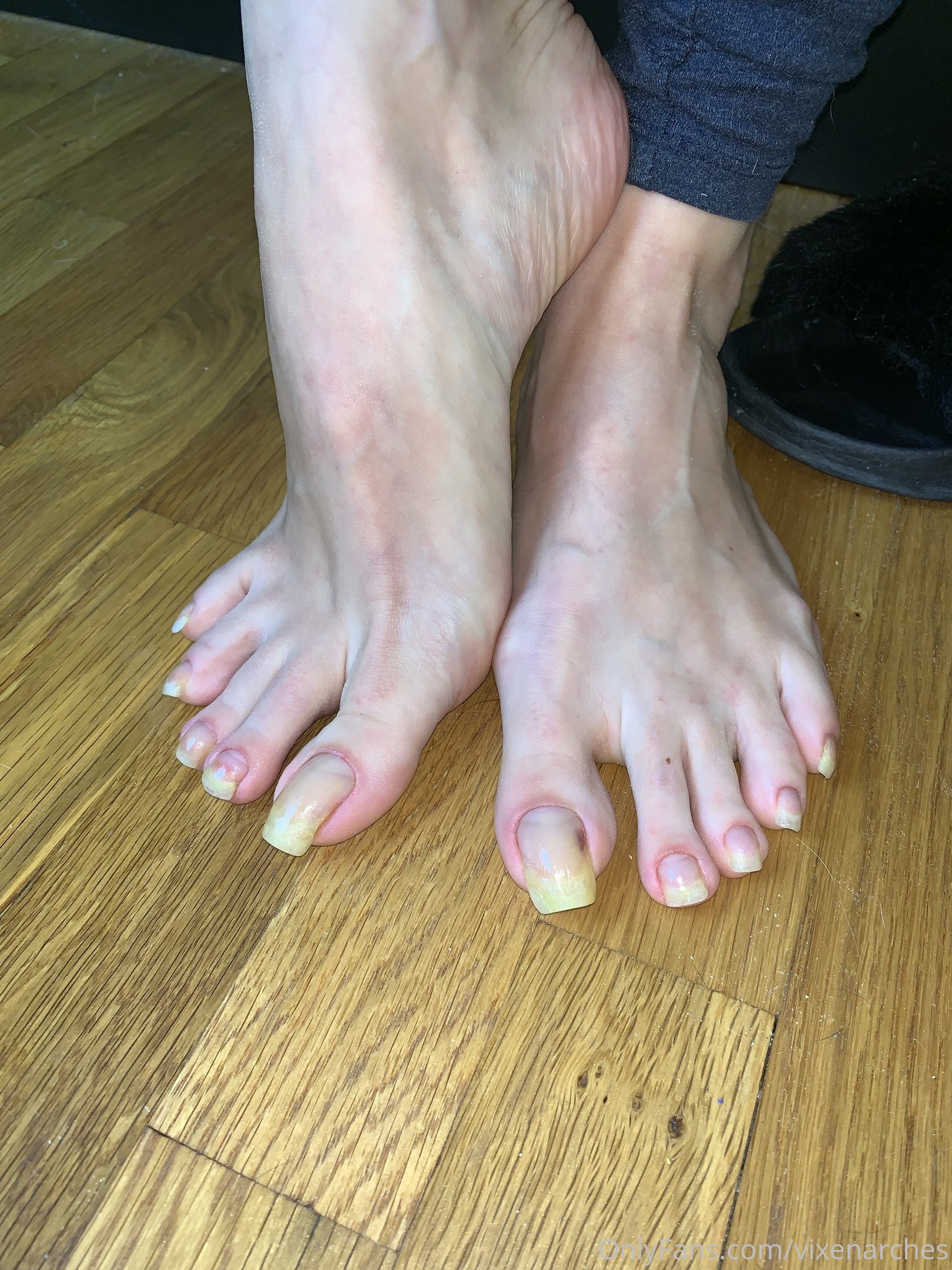 vixenarches feet photo 18