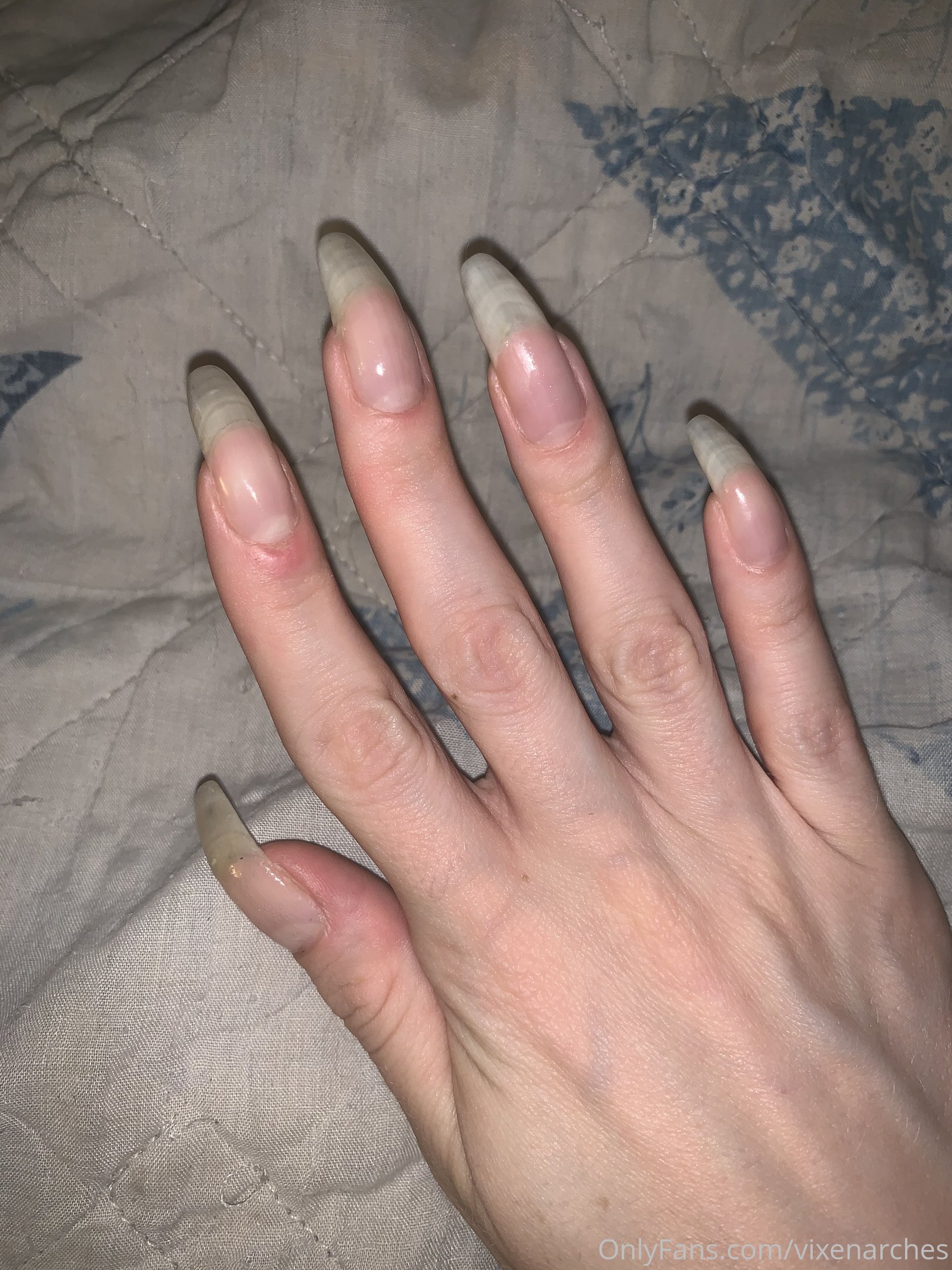 vixenarches feet photo 12