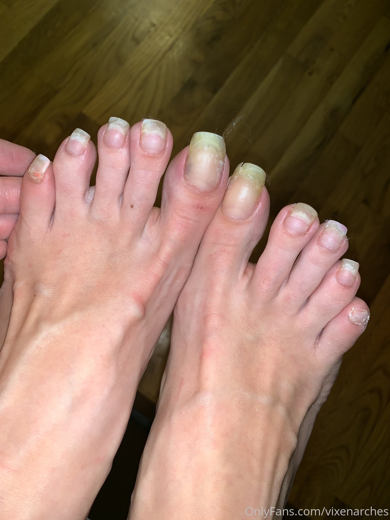 vixenarches feet photo 13