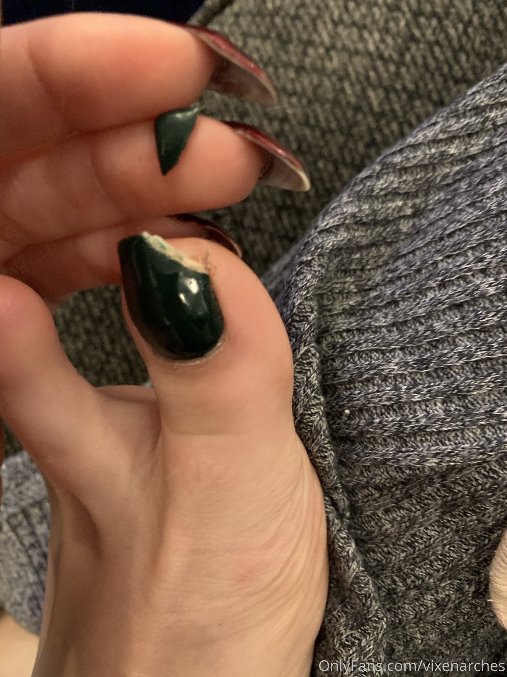 vixenarches feet photo 20