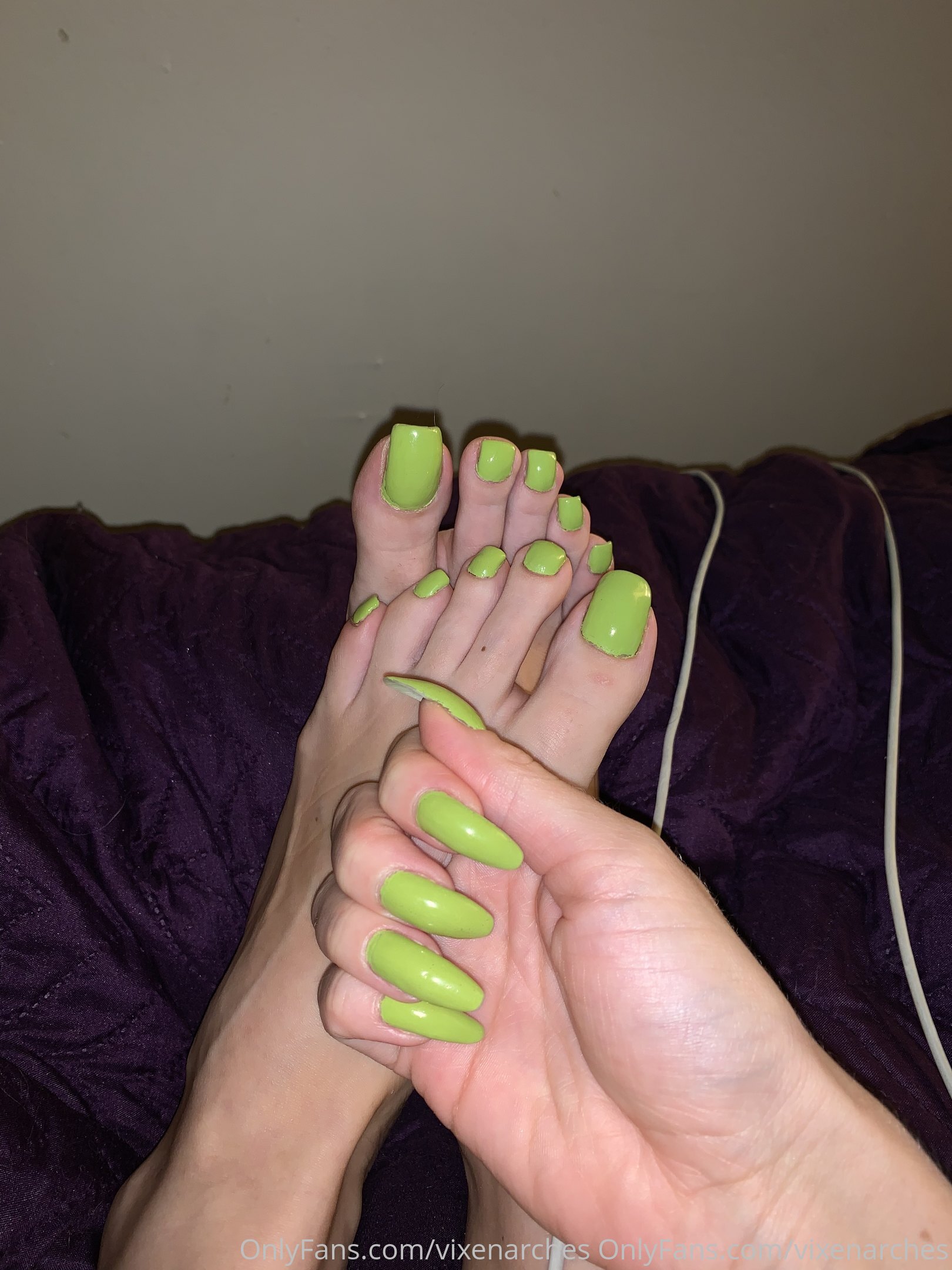 vixenarches feet photo 24