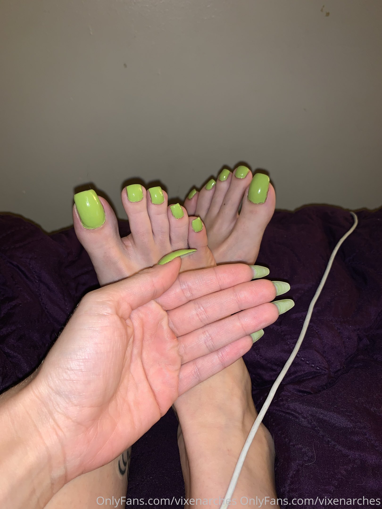 vixenarches feet photo 21