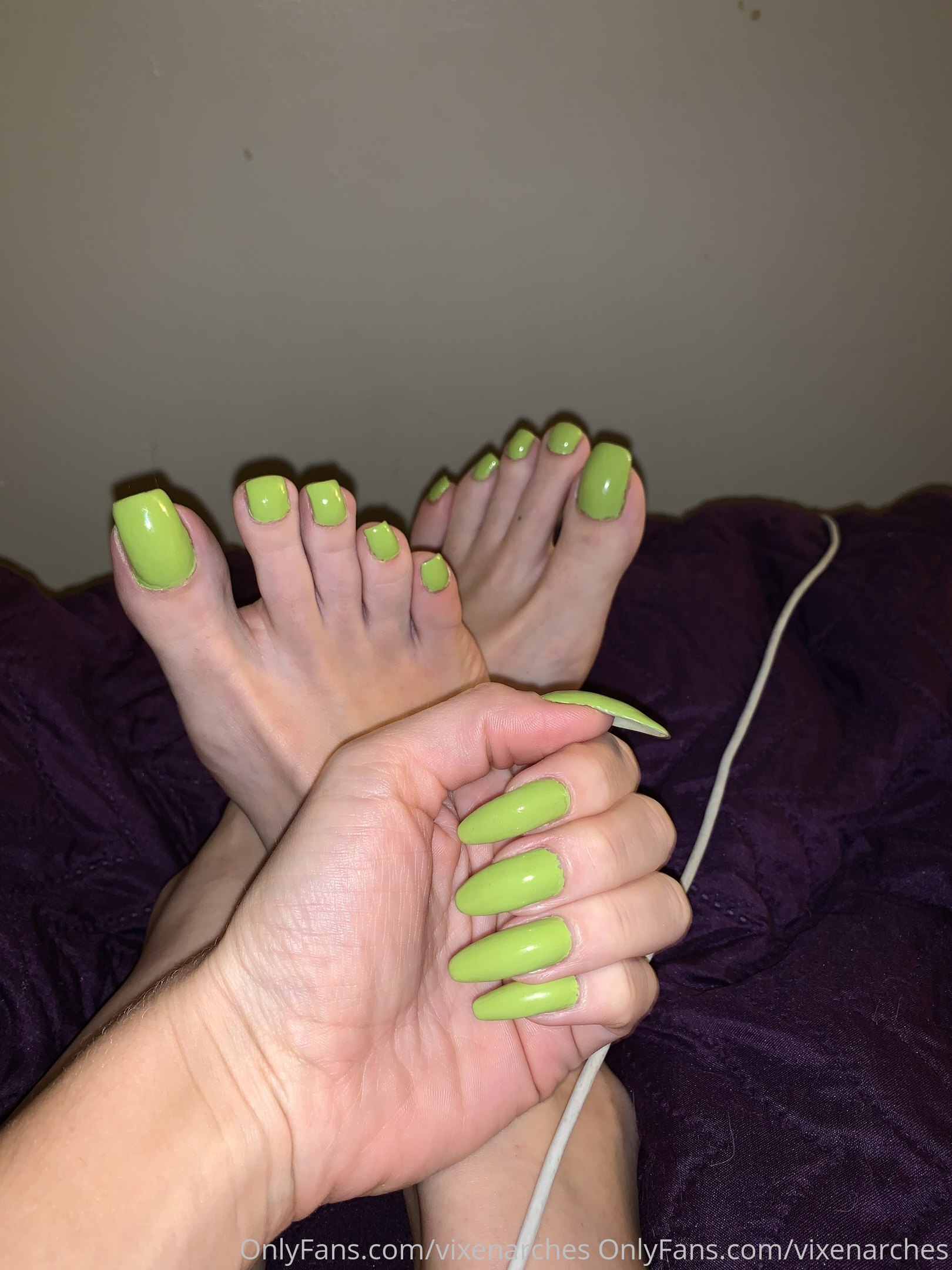 vixenarches feet photo 22