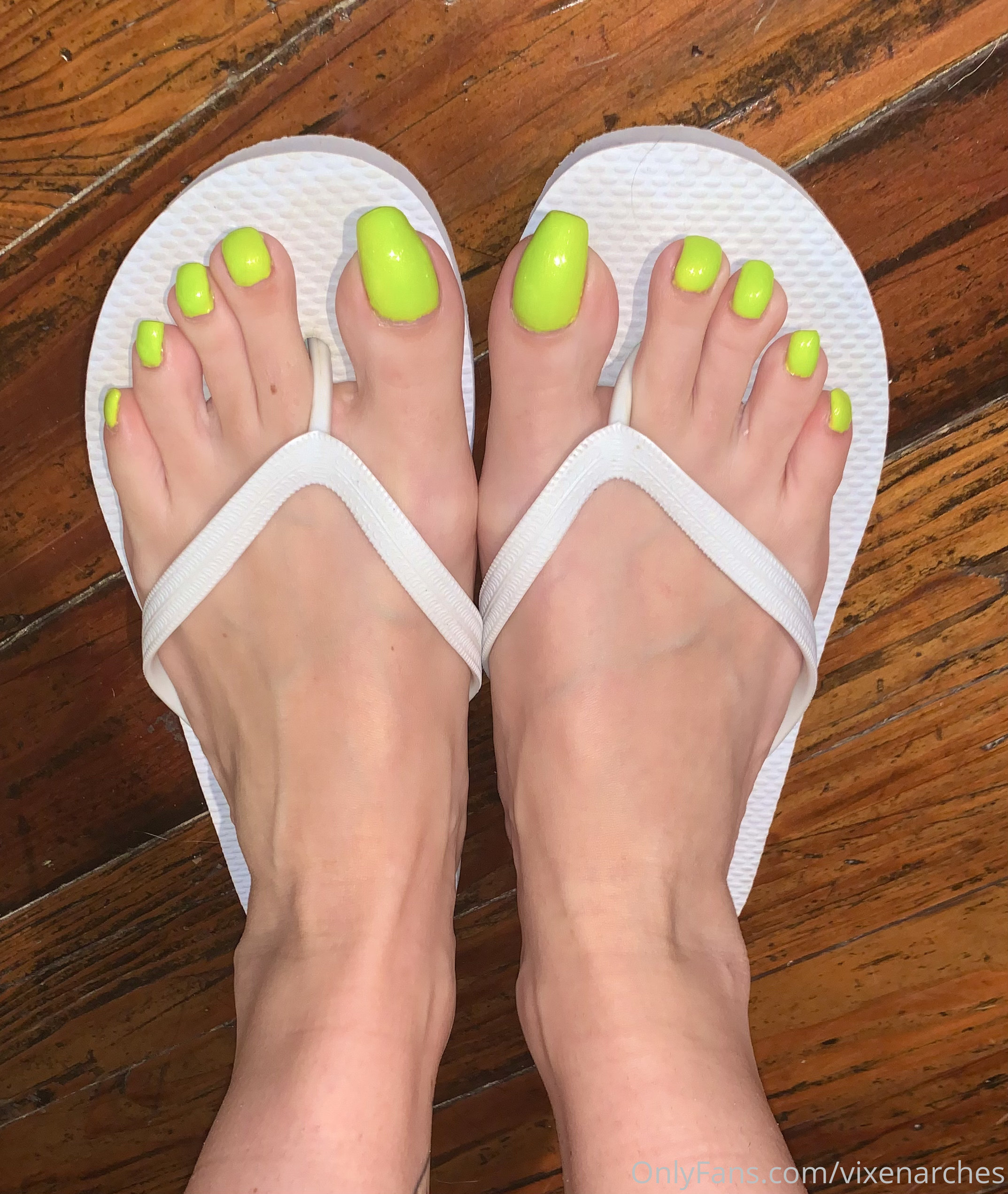 vixenarches feet photo 18