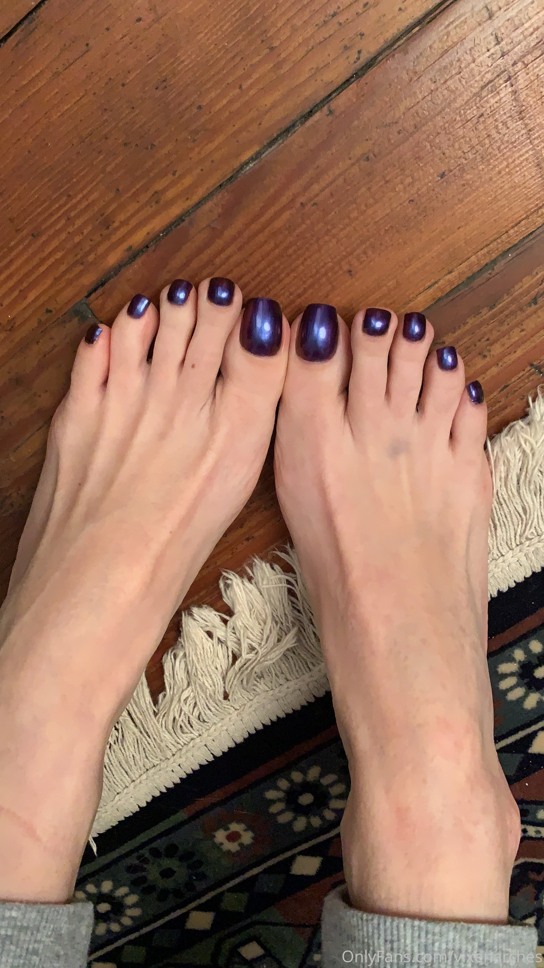 vixenarches feet photo 1