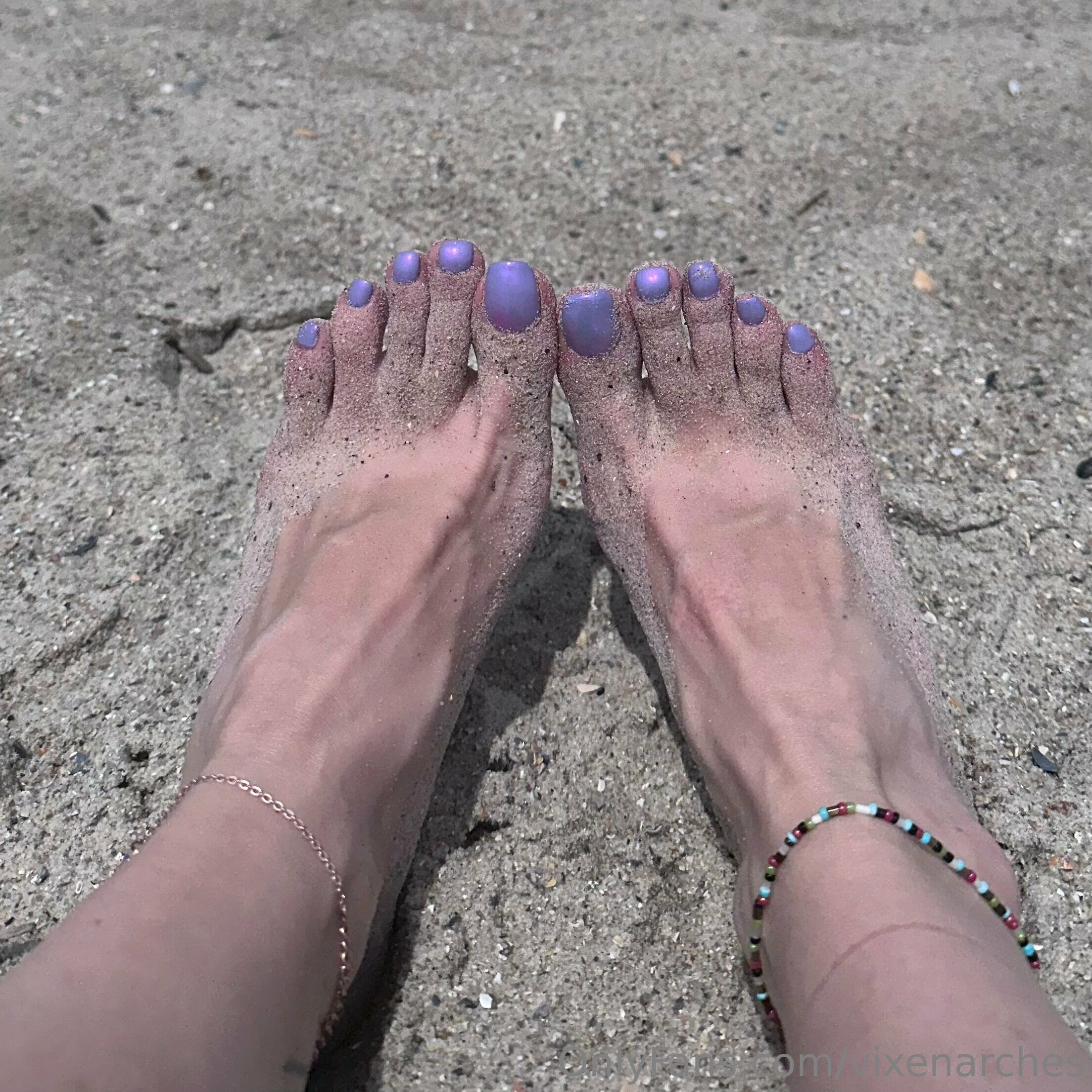 vixenarches feet photo 23