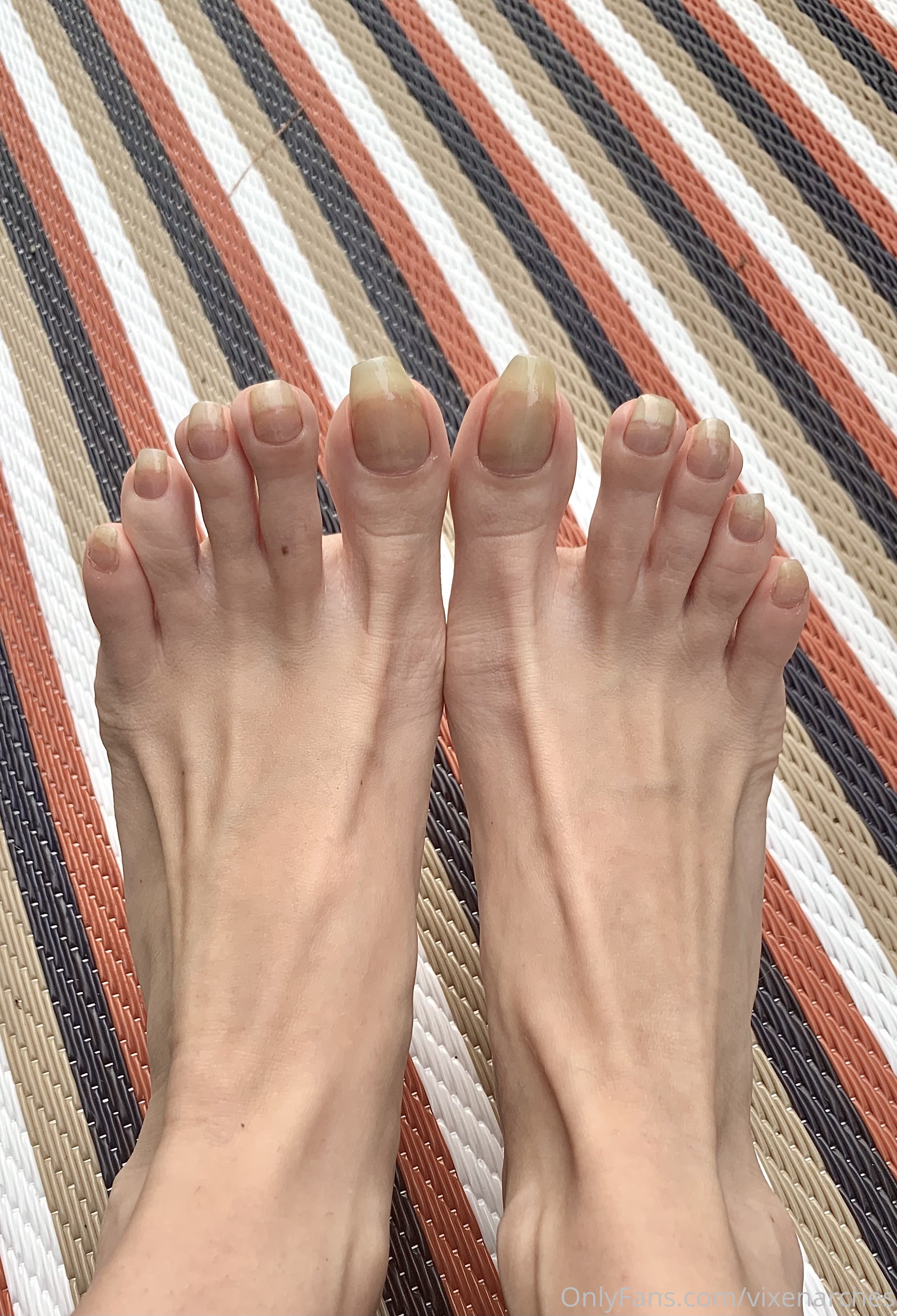 vixenarches feet photo 1
