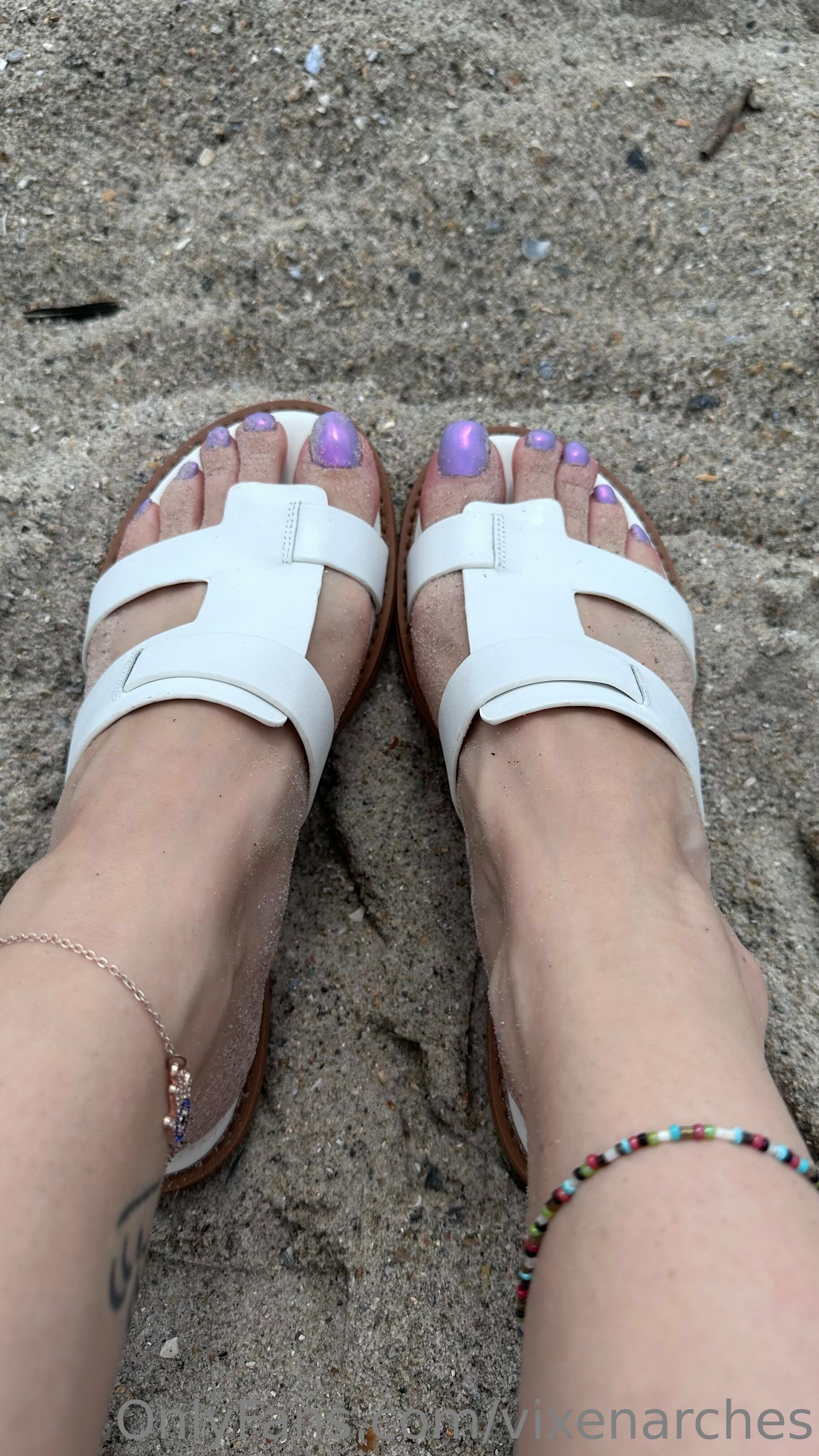 vixenarches feet photo 21