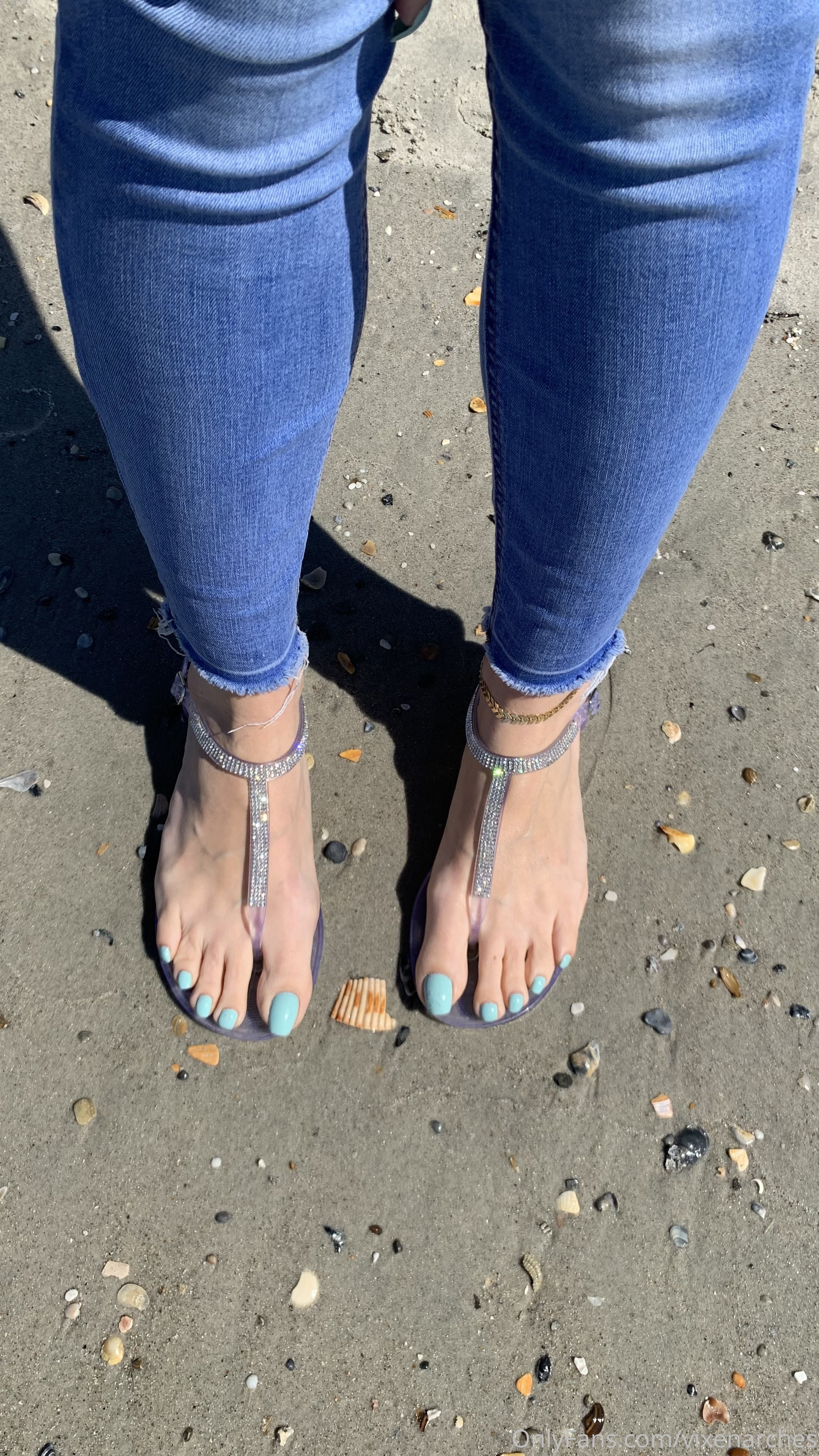 vixenarches feet photo 23