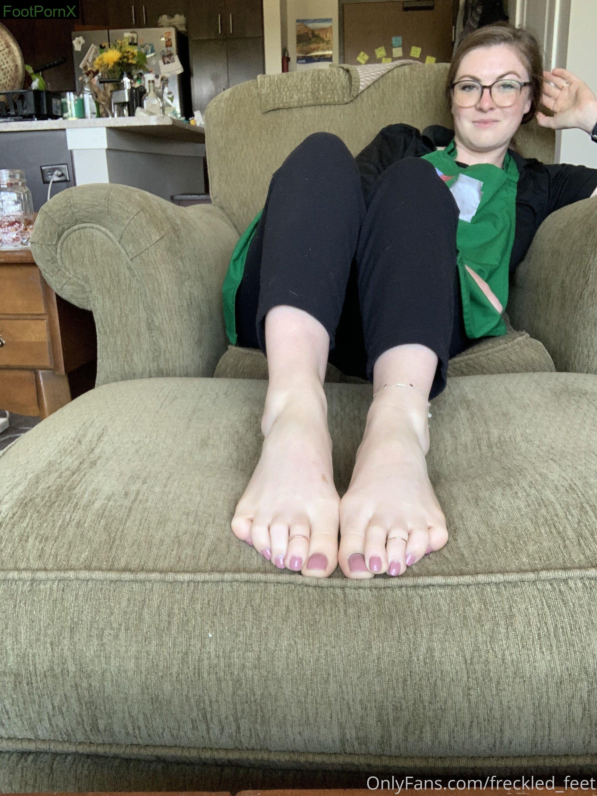 freckled feet feet photo 3