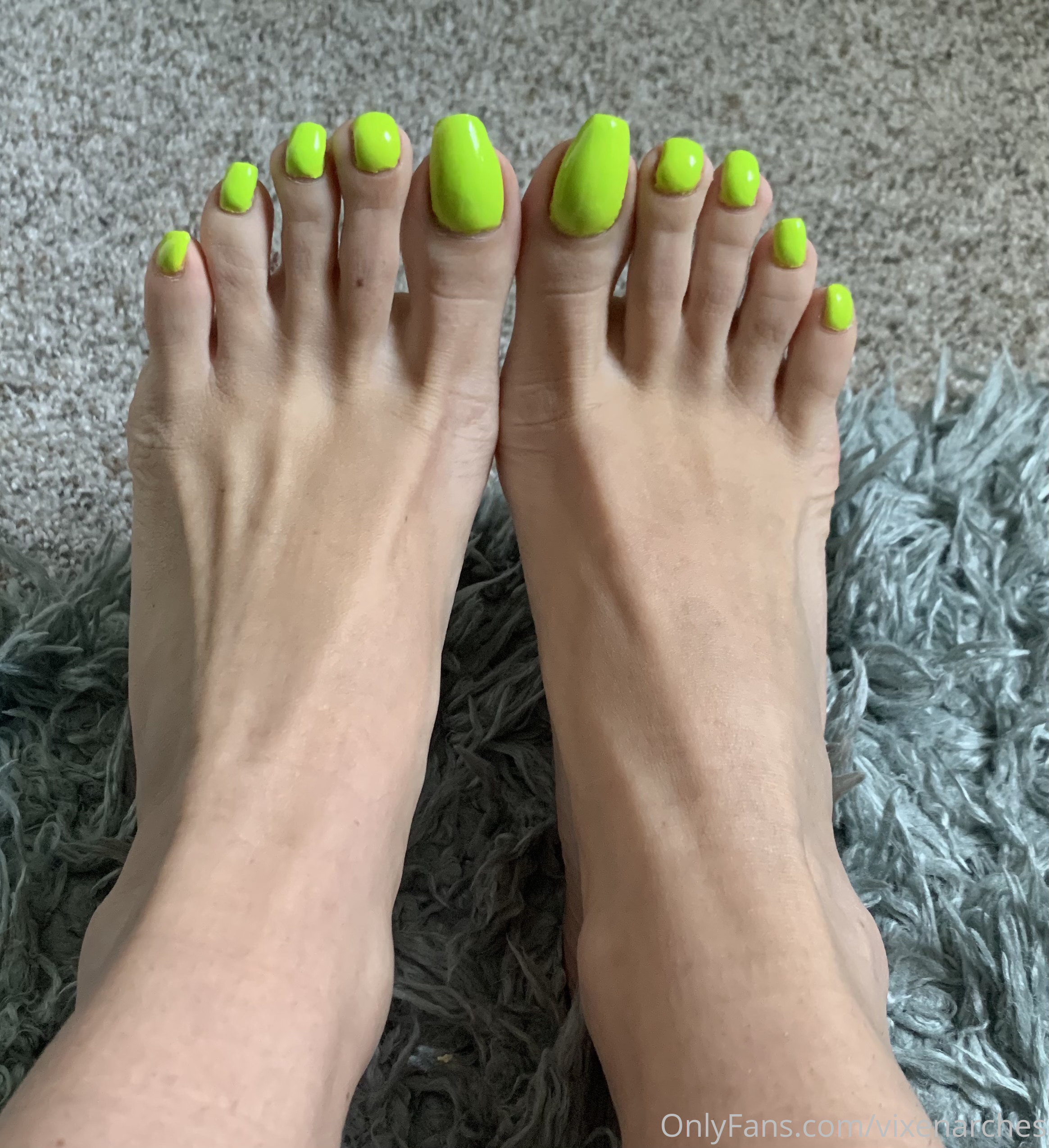 vixenarches feet photo 14