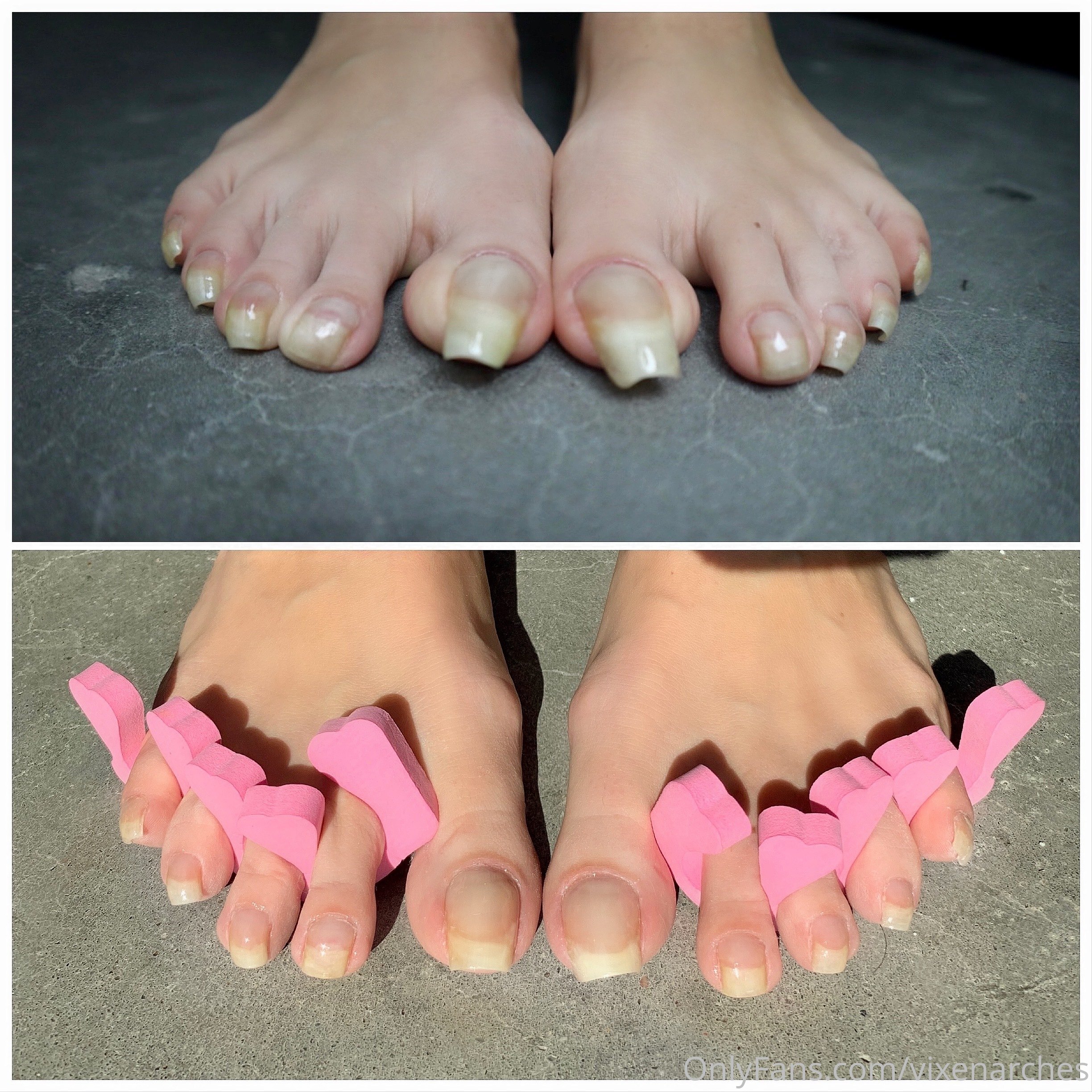vixenarches feet photo 22