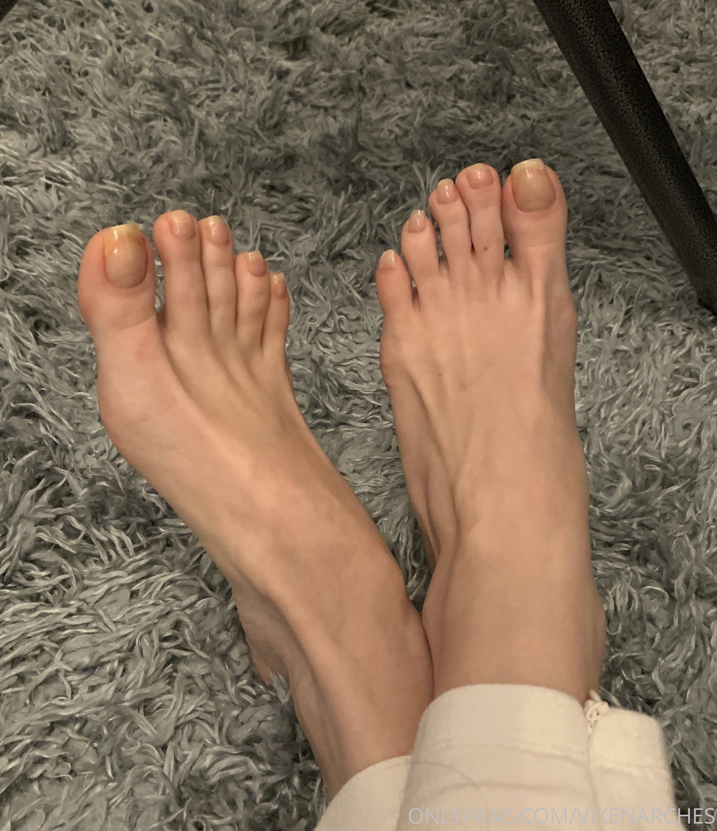 vixenarches feet photo 12