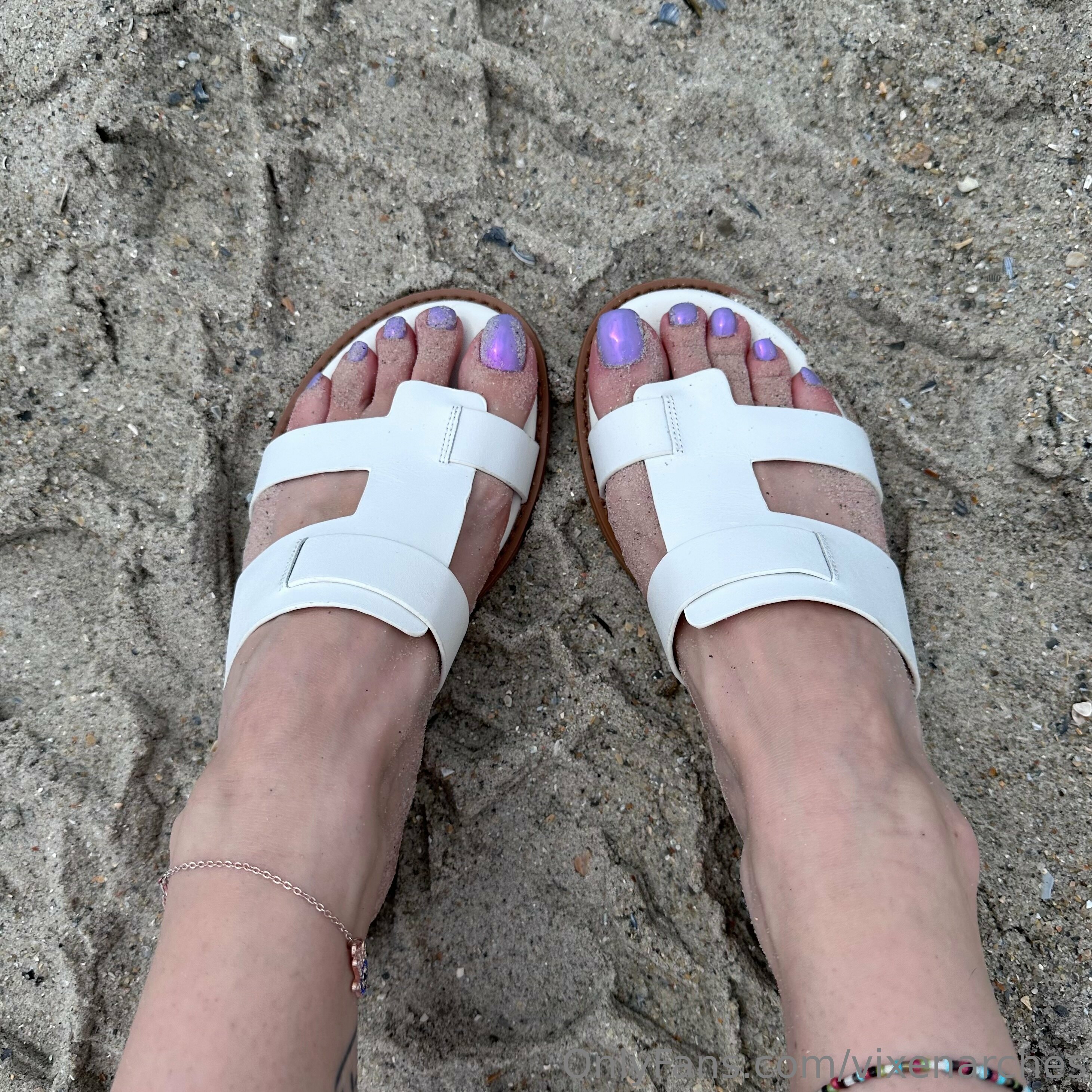 vixenarches feet photo 20