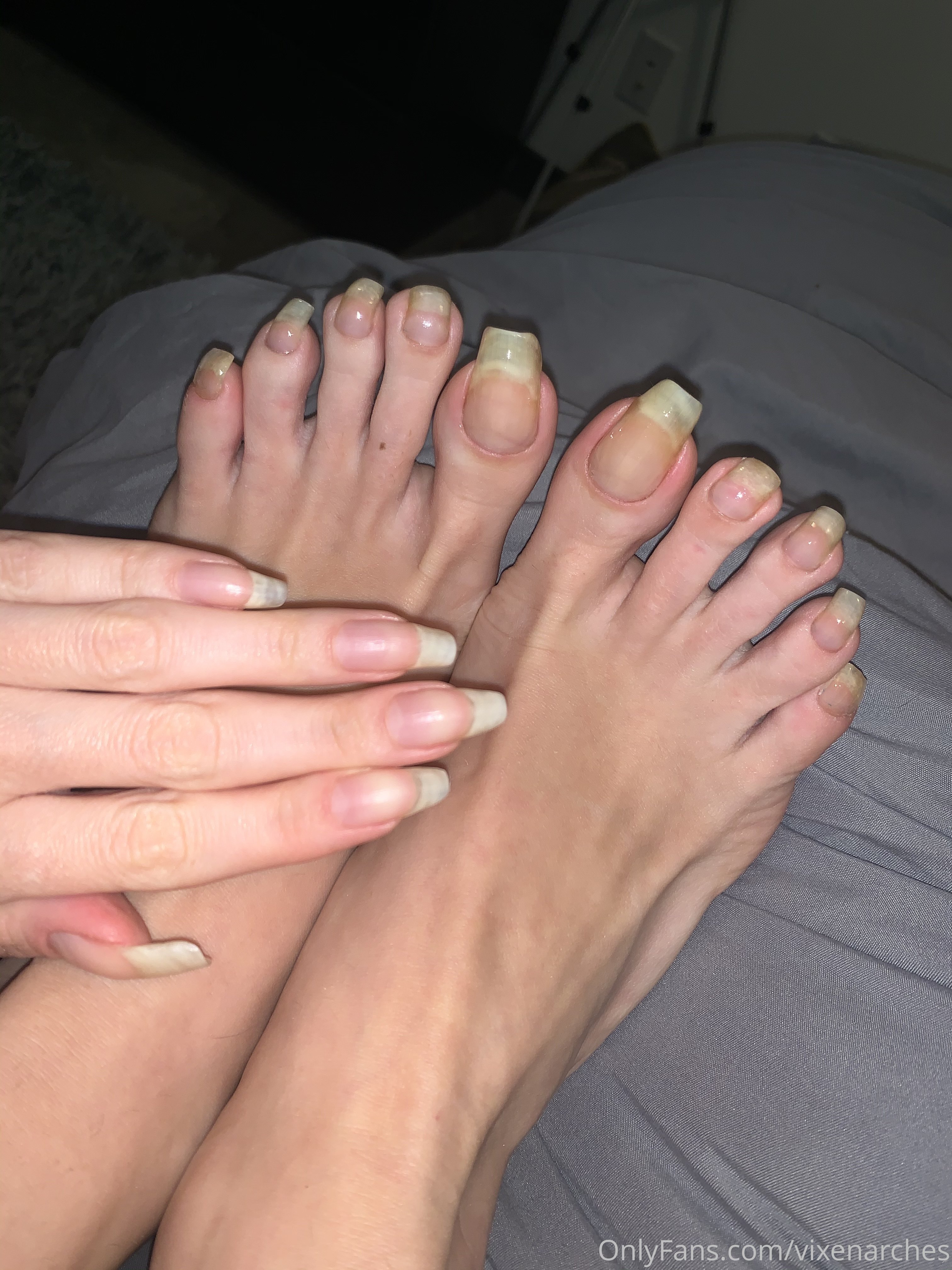 vixenarches feet photo 21