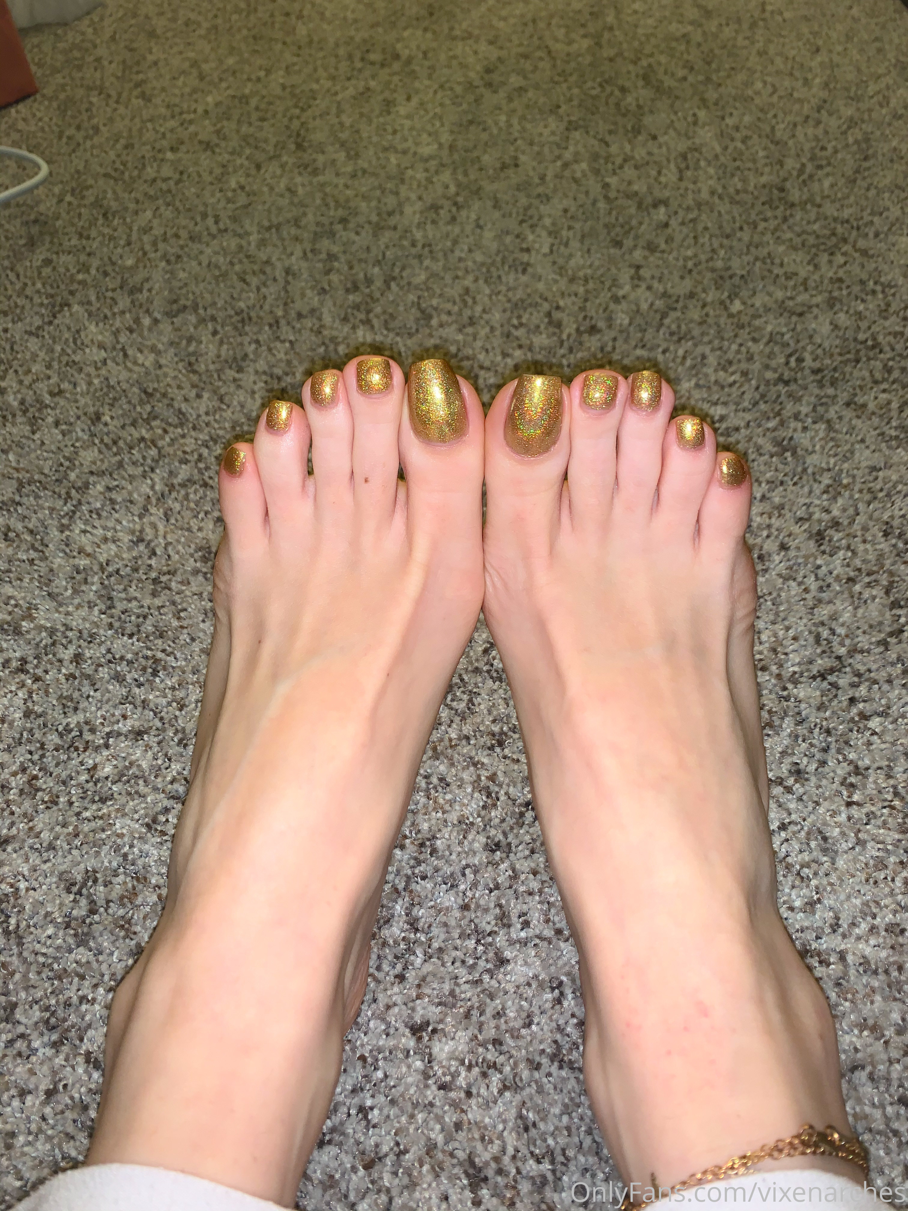 vixenarches feet photo 1