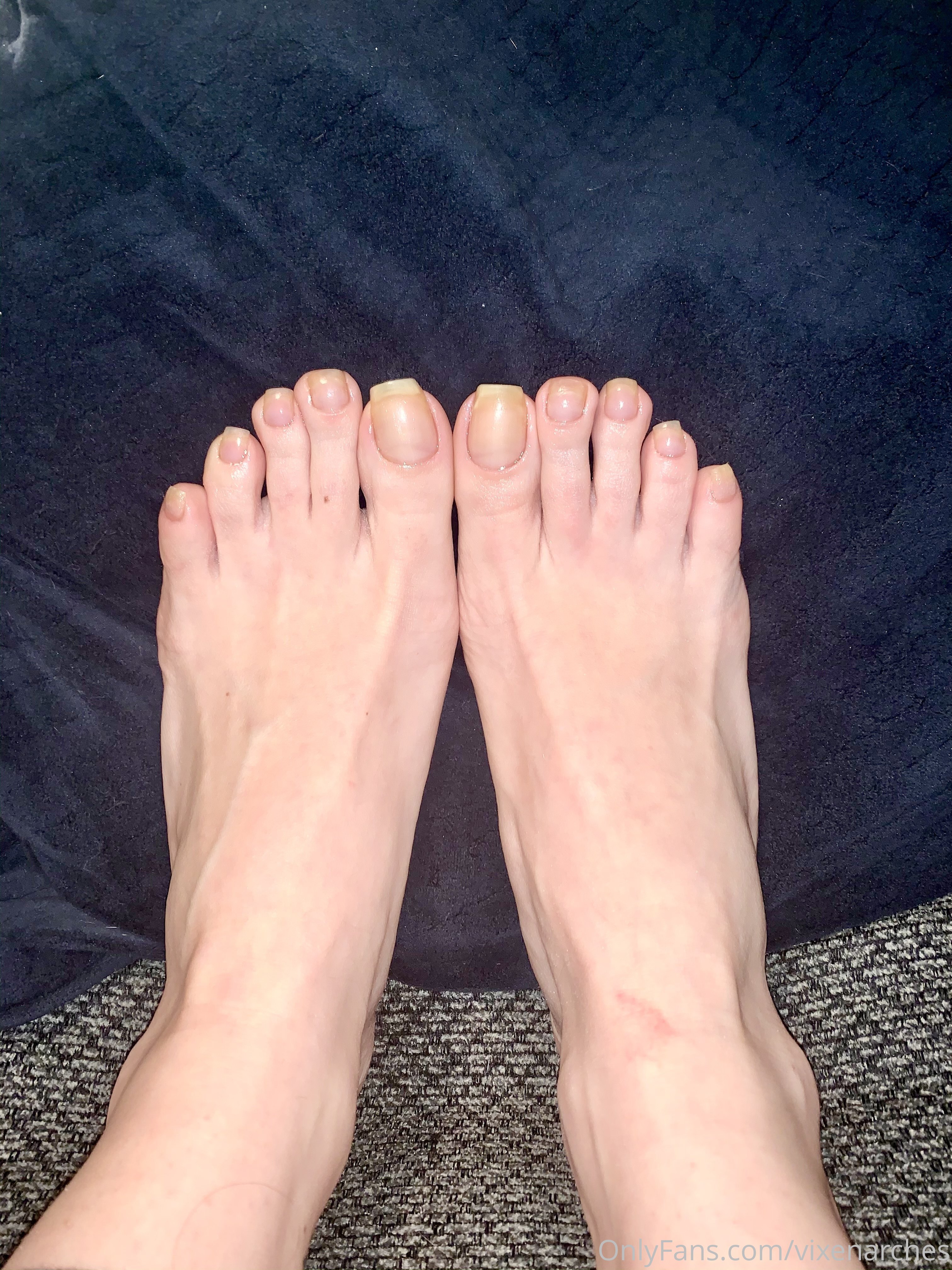 vixenarches feet photo 6