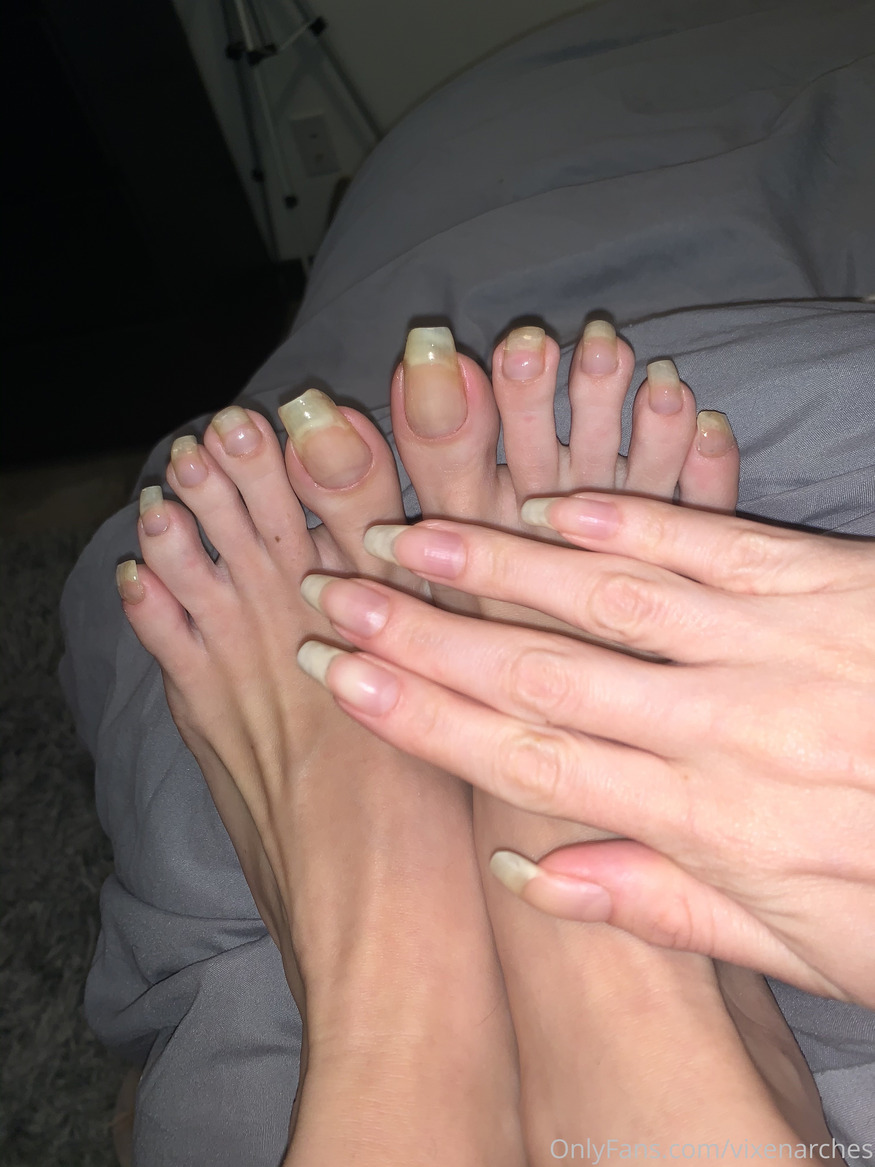 vixenarches feet photo 14