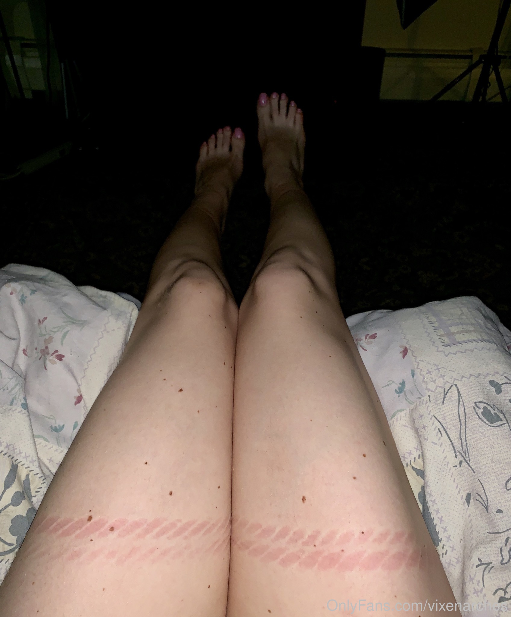 vixenarches feet photo 24
