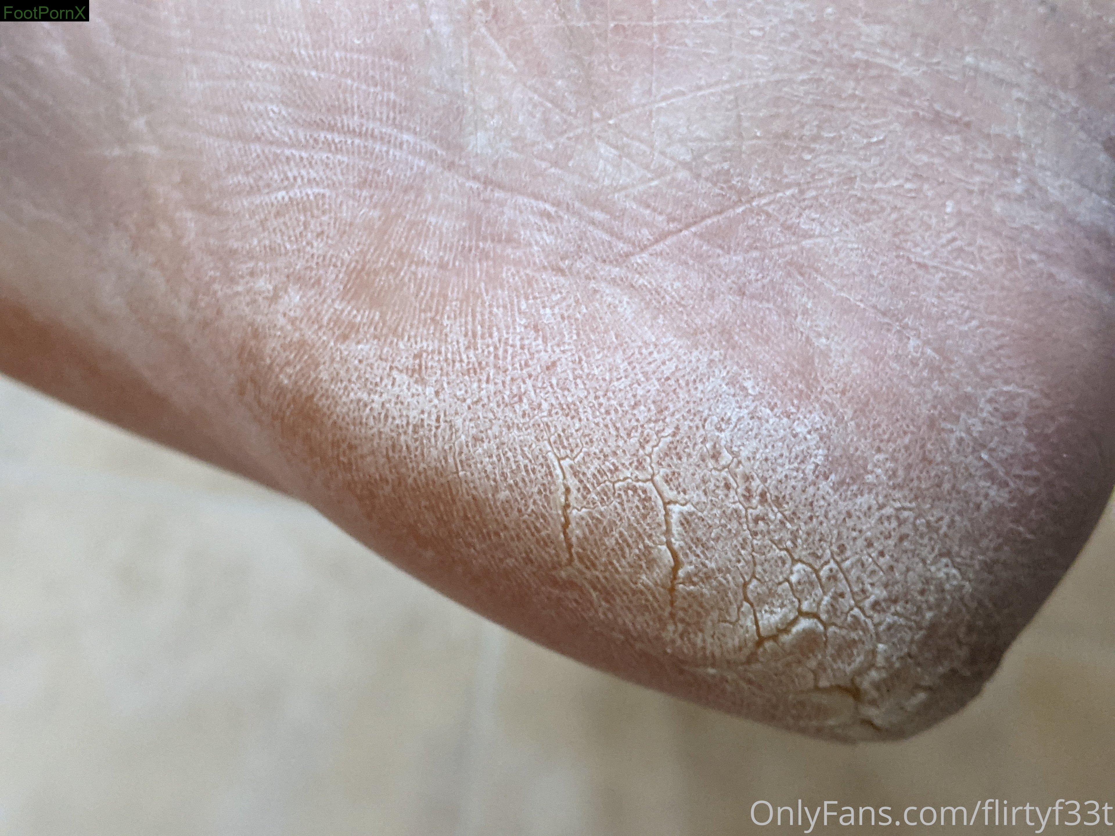 flirtyf33t feet photo 16