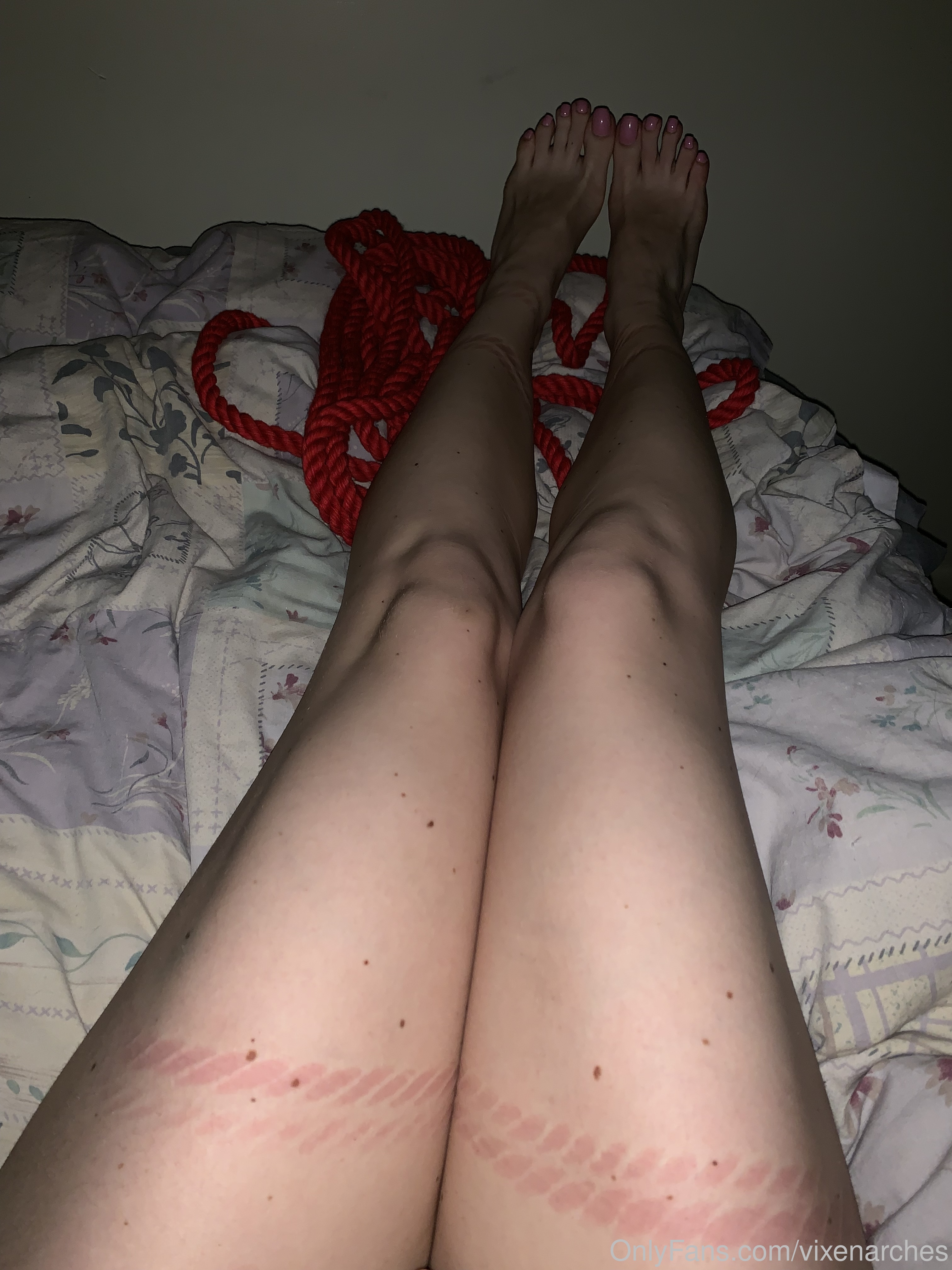 vixenarches feet photo 15